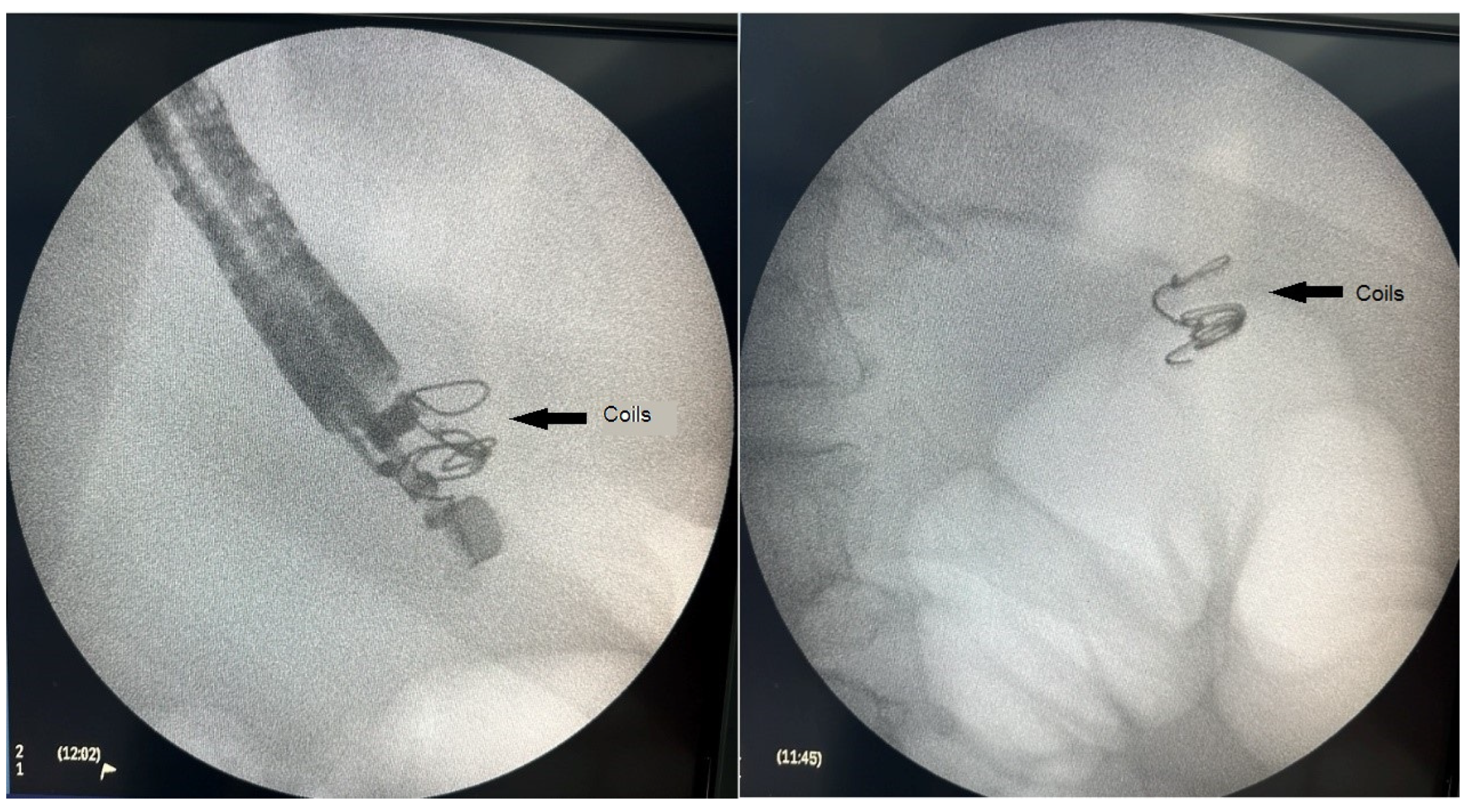 Medicina 60 00116 g003