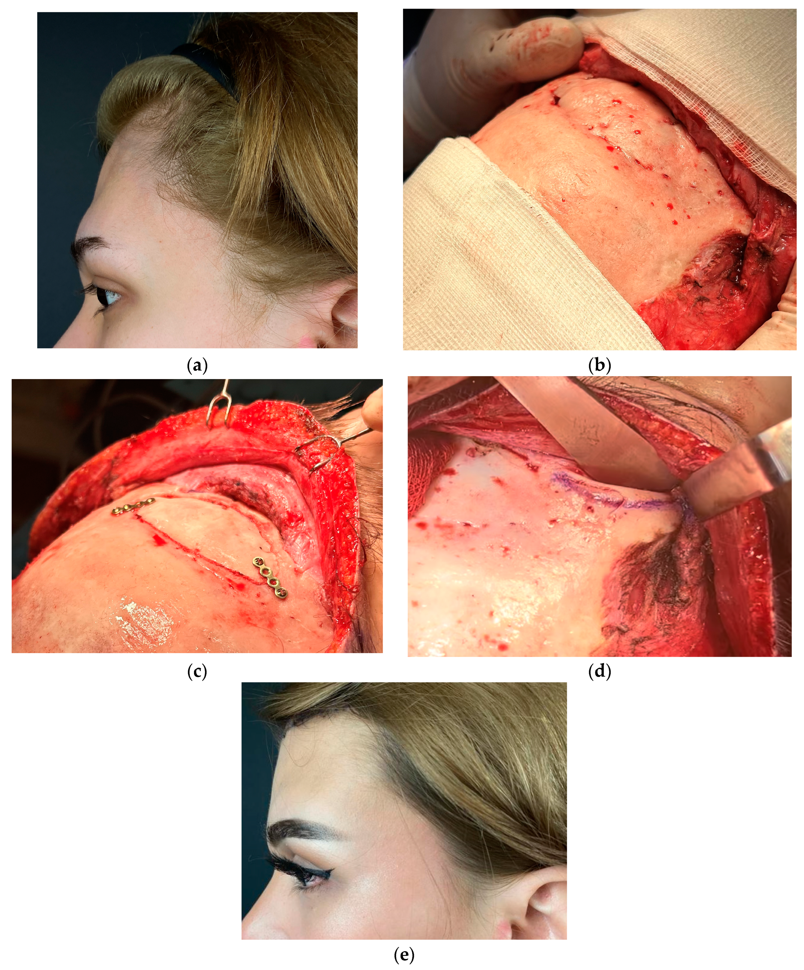 Medicina 60 00120 g002