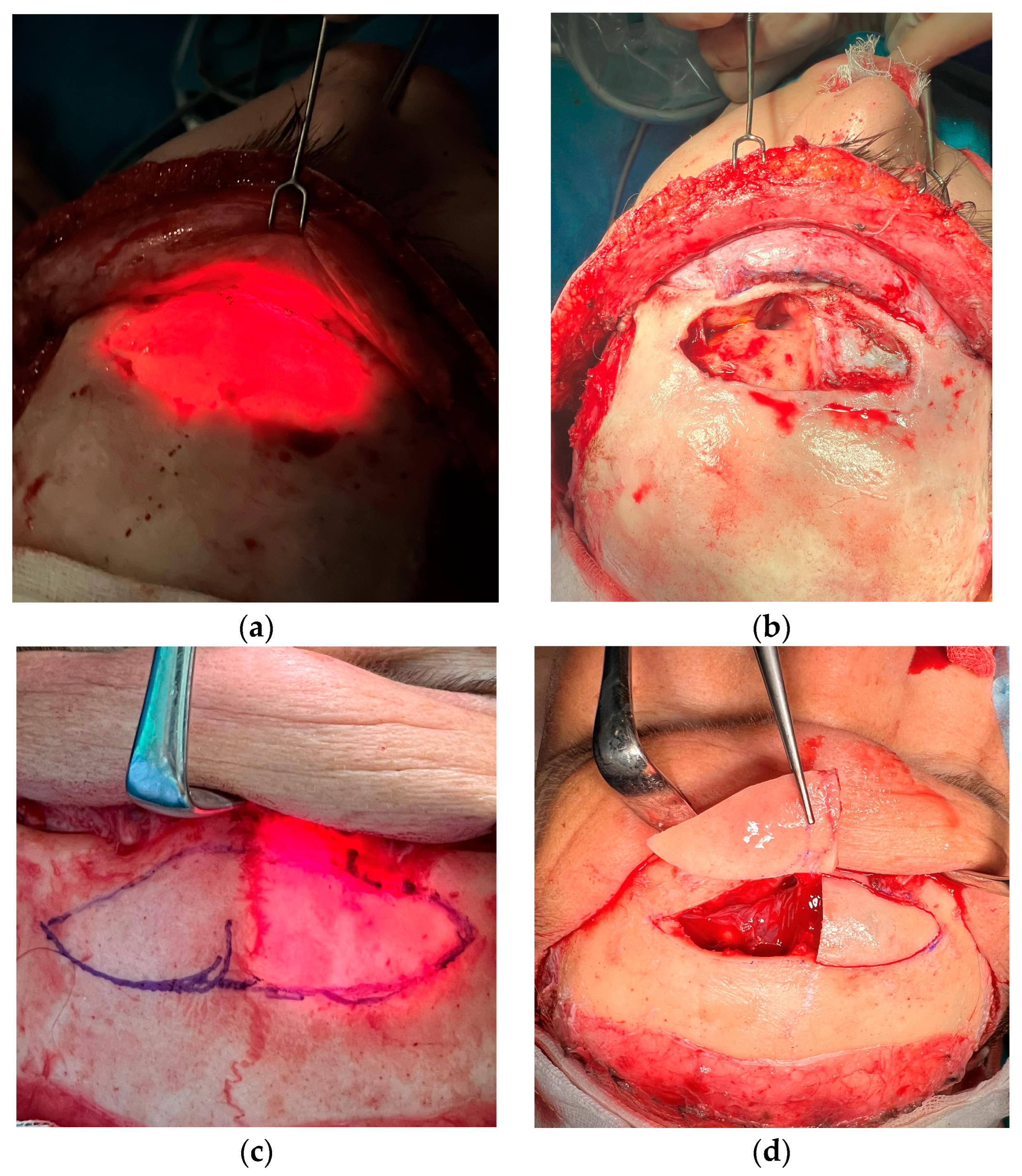 Medicina 60 00120 g003