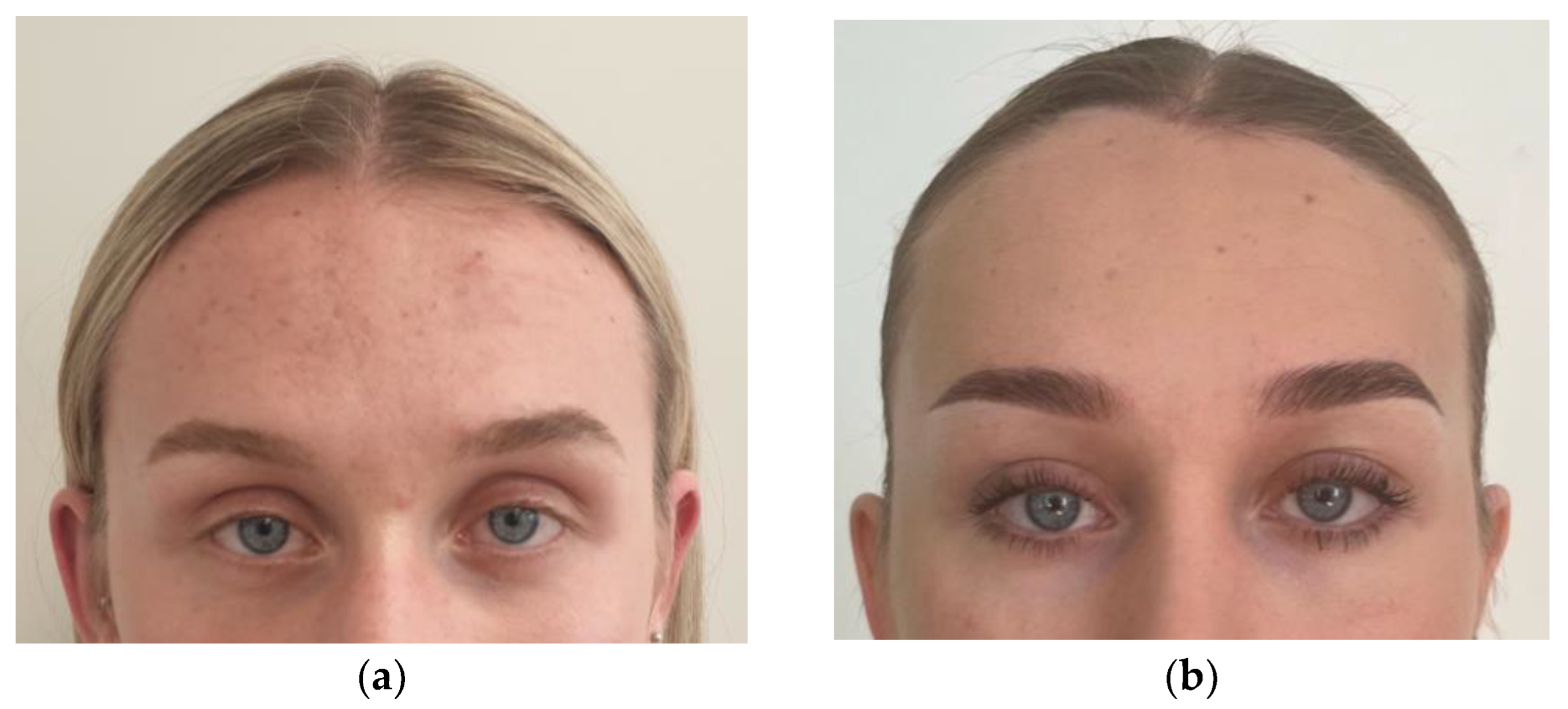 Medicina 60 00120 g004a