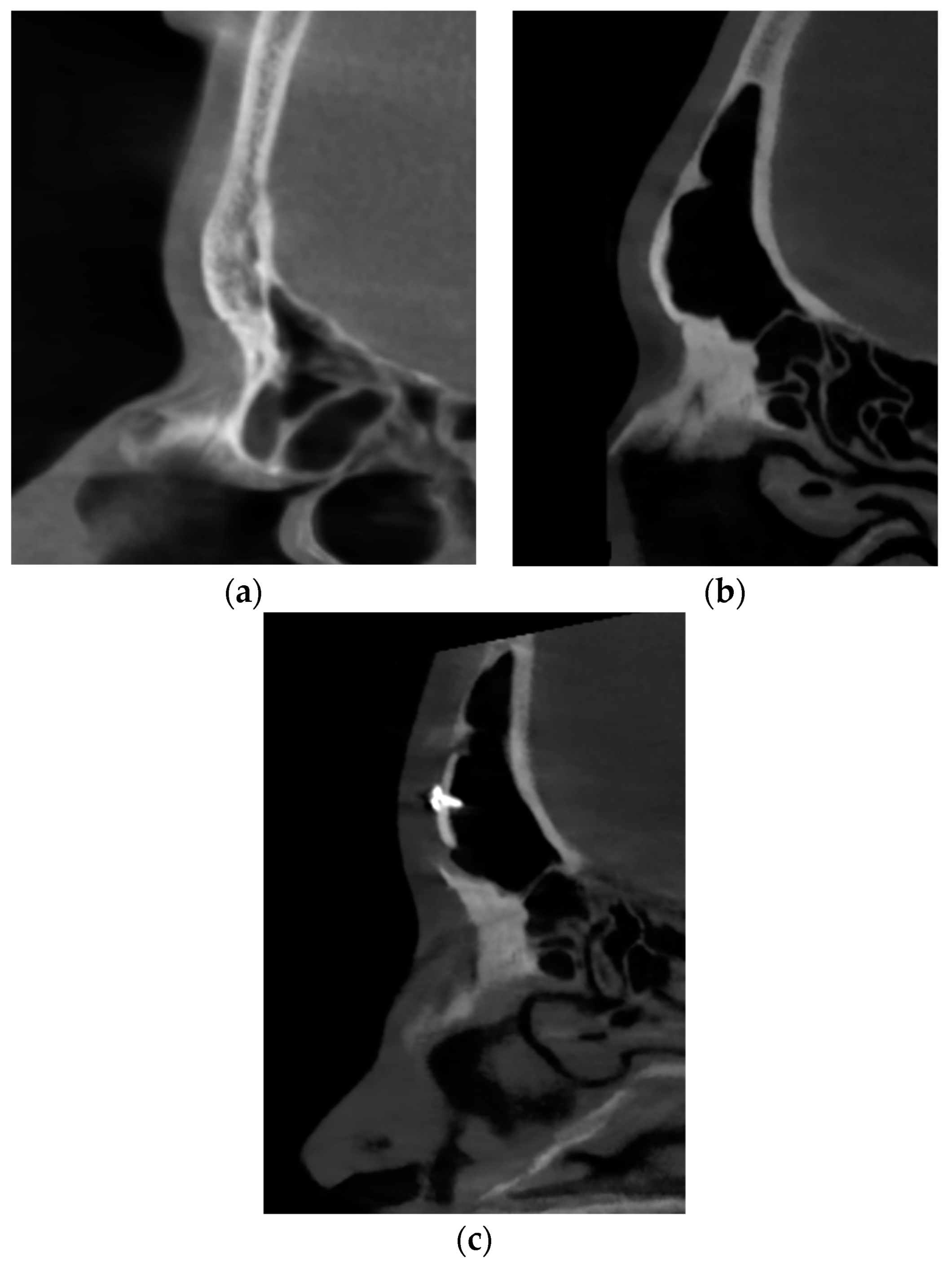 Medicina 60 00120 g005