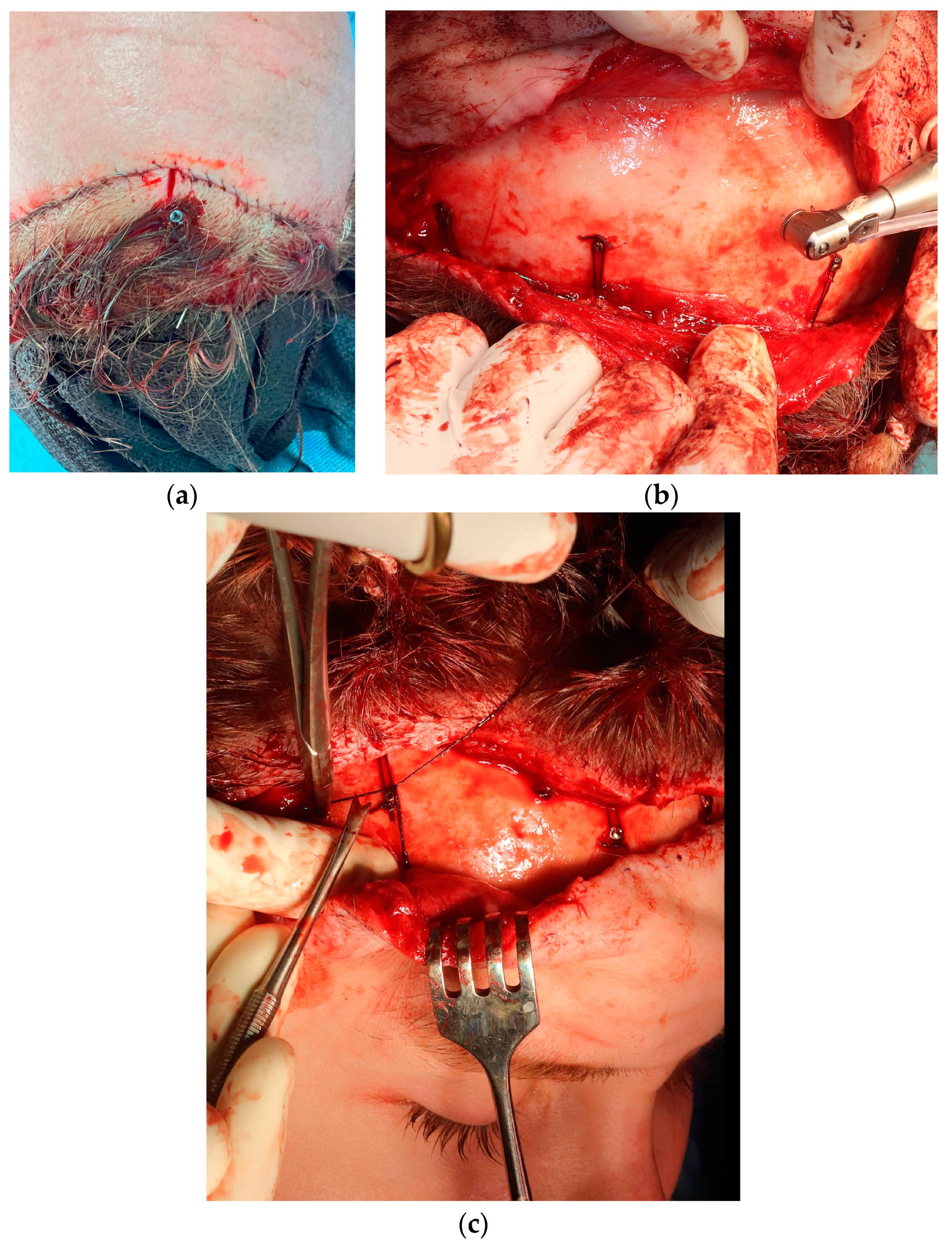 Medicina 60 00120 g006