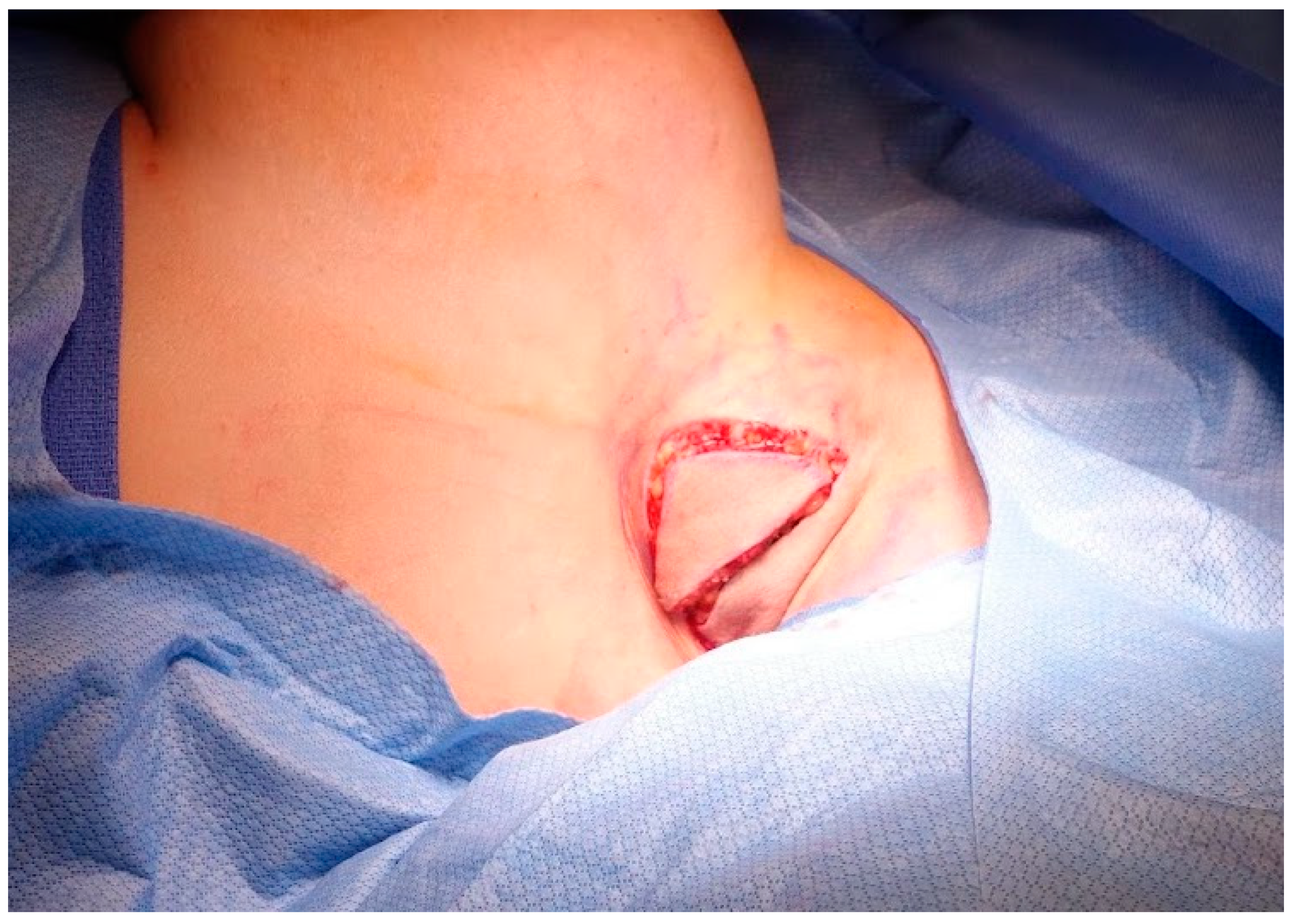 Medicina 60 00126 g003