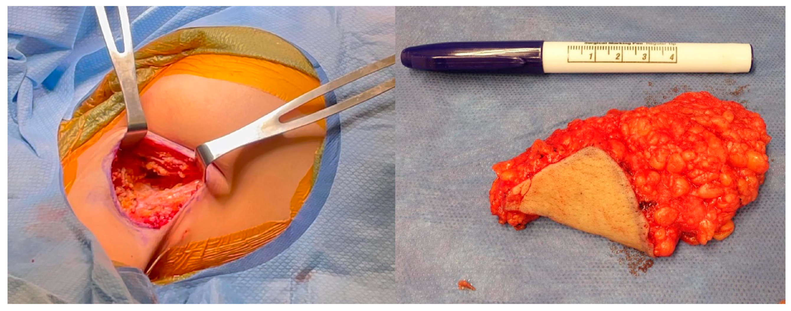 Medicina 60 00126 g005