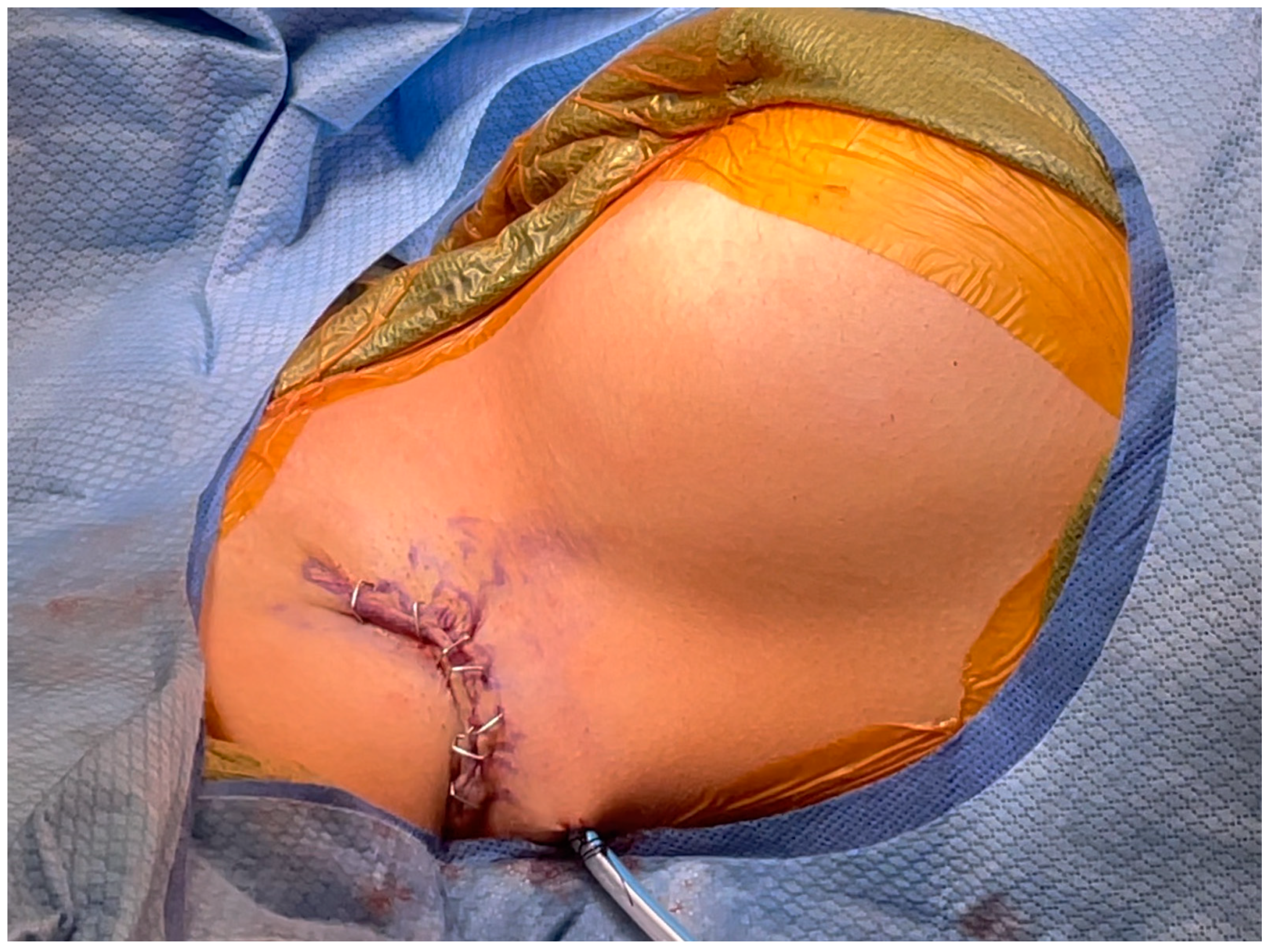 Medicina 60 00126 g006