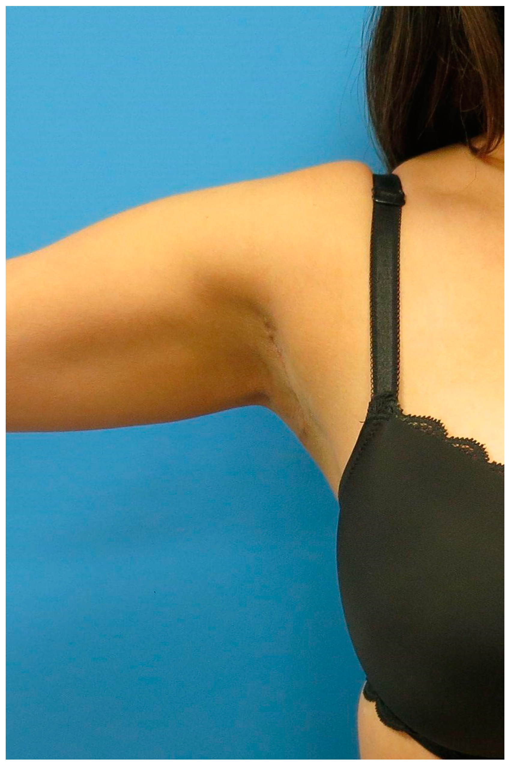 Medicina 60 00126 g007