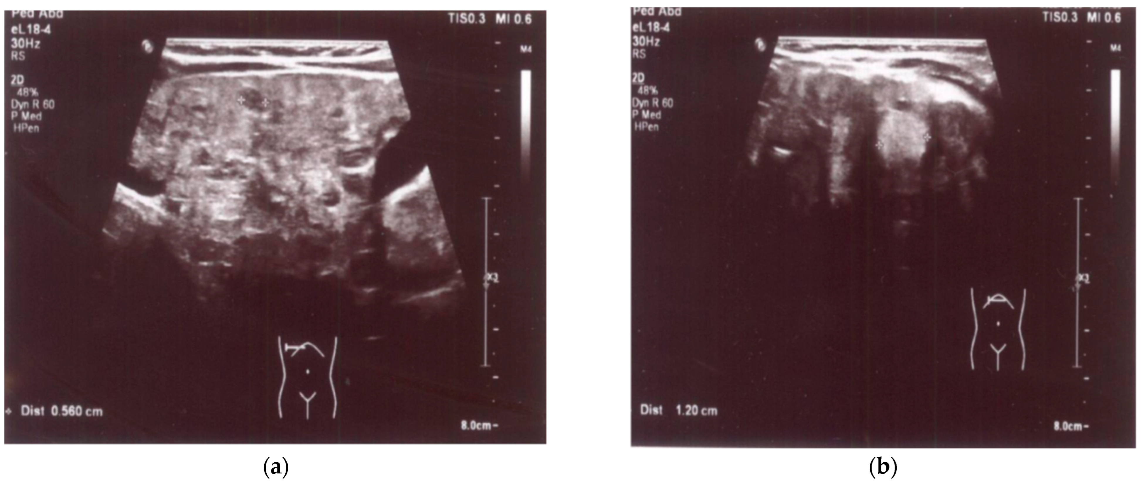 Medicina 60 00135 g001