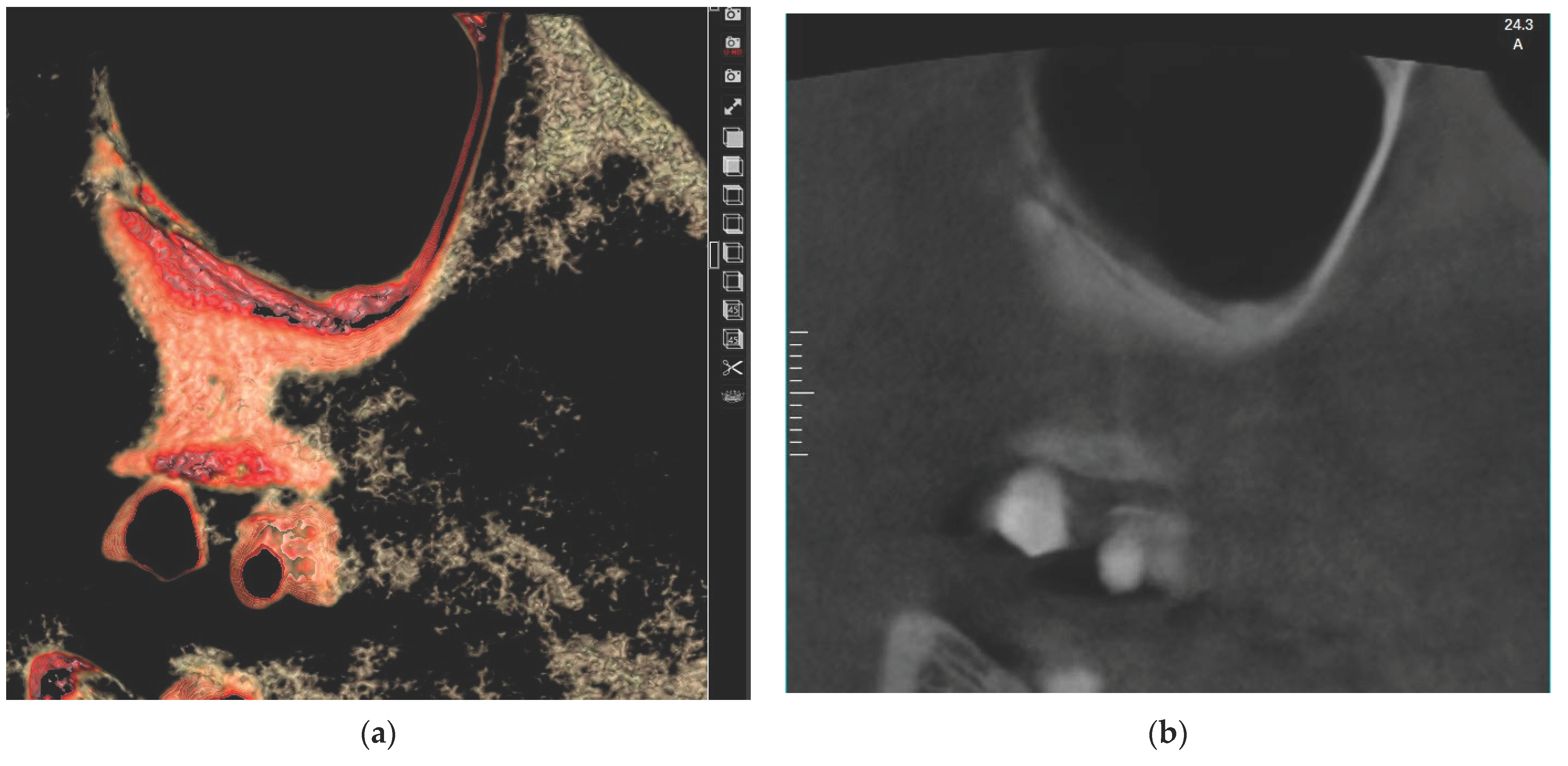 Medicina 60 00140 g001