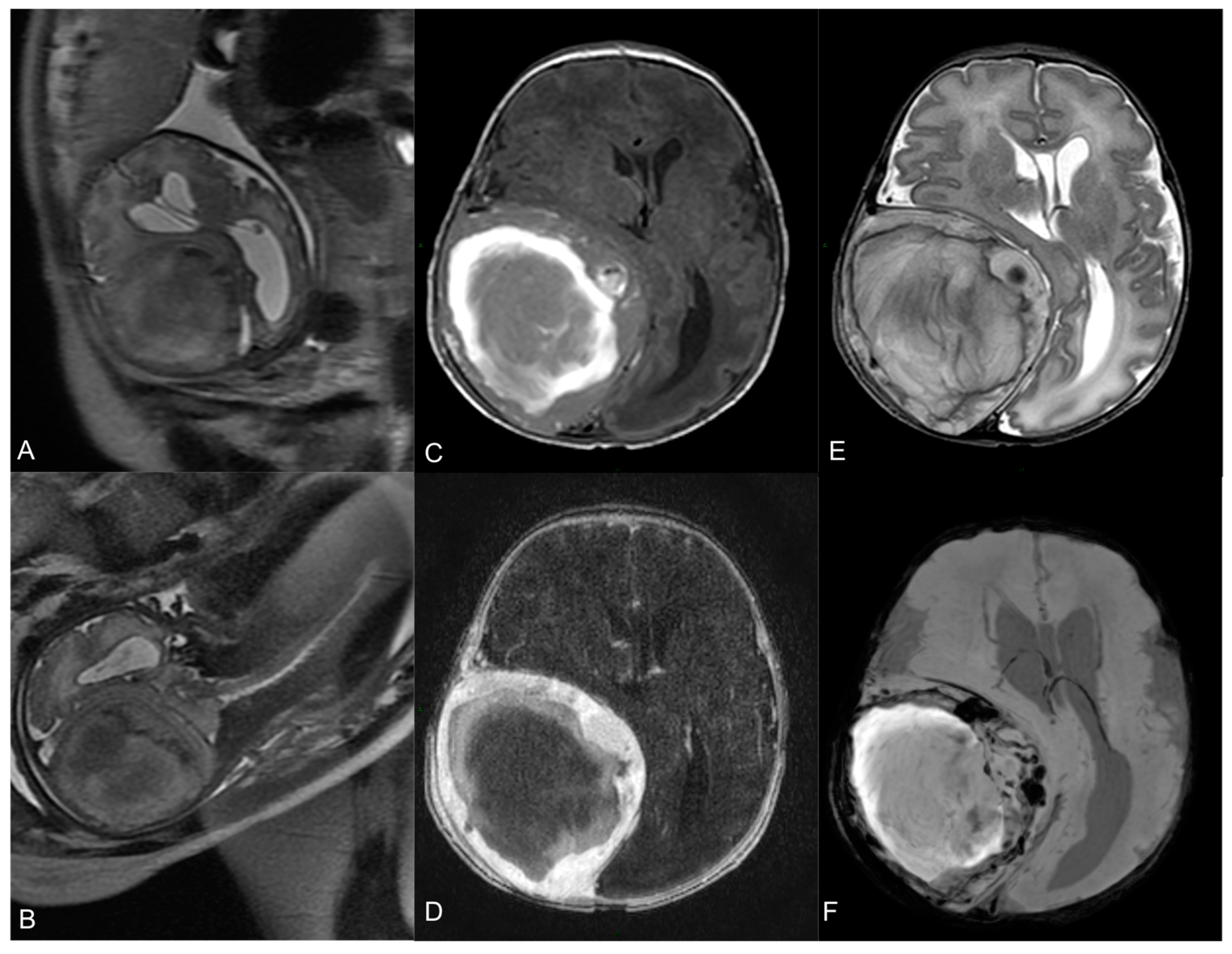 Medicina 60 00145 g001