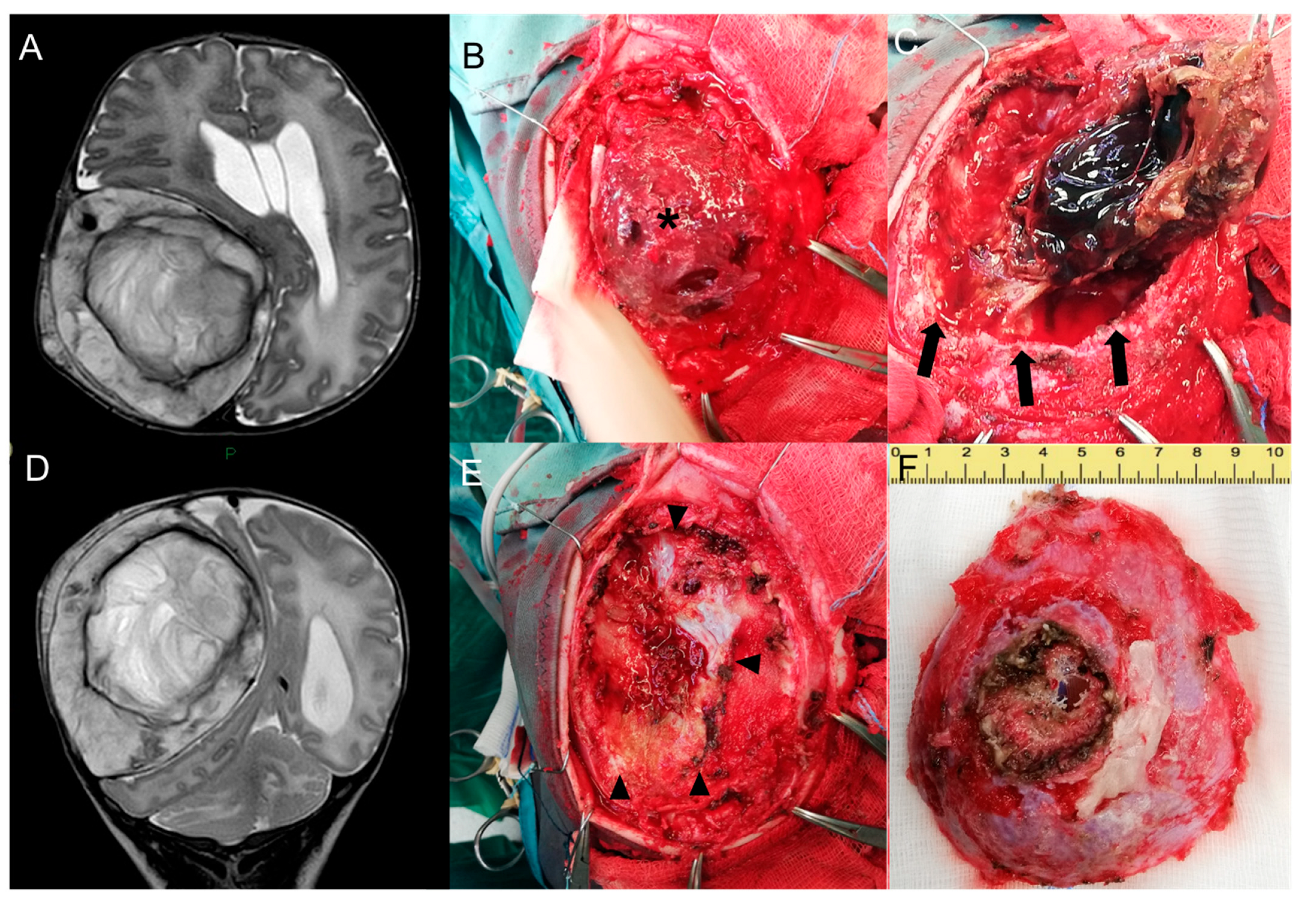 Medicina 60 00145 g003