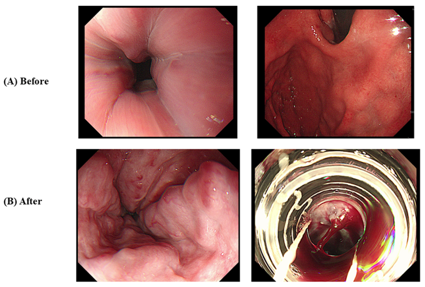 Medicina 60 00157 g001