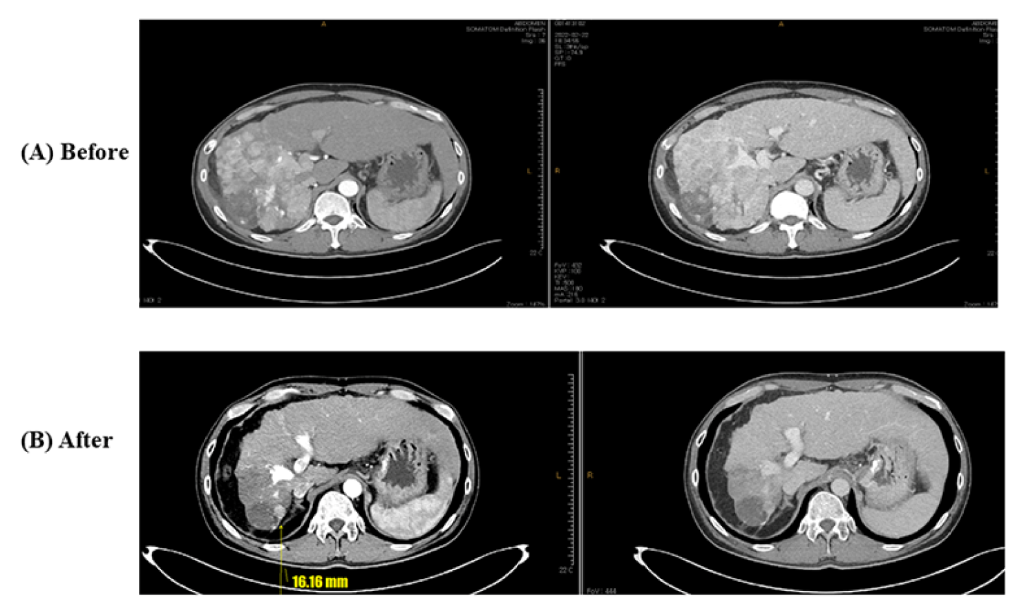 Medicina 60 00157 g002