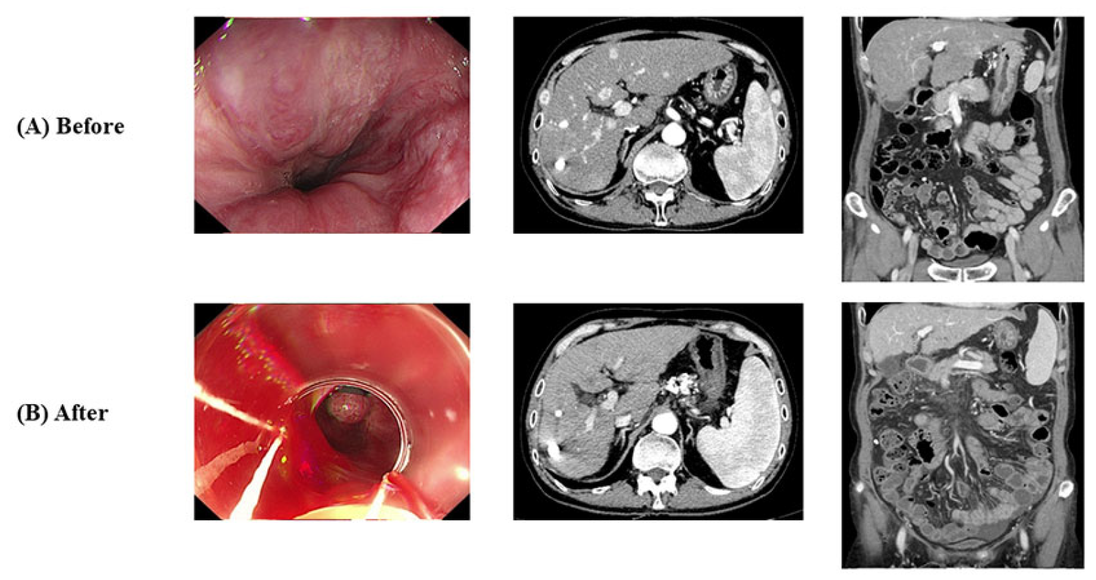 Medicina 60 00157 g004