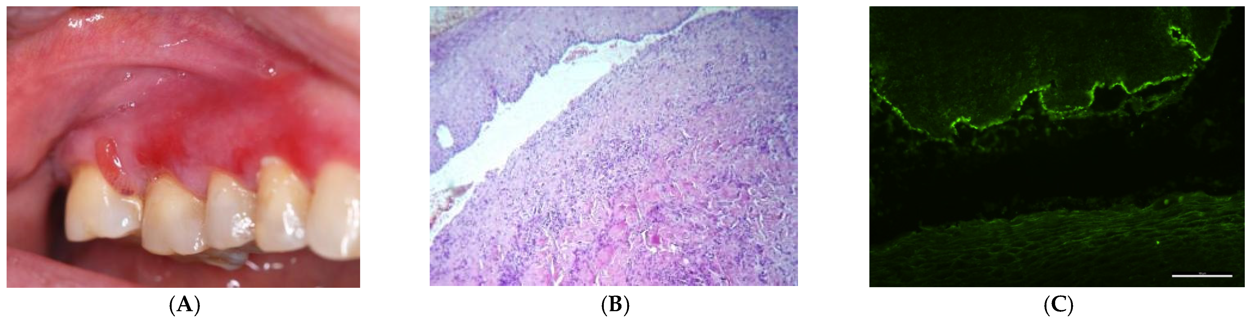 Medicina 60 00167 g001
