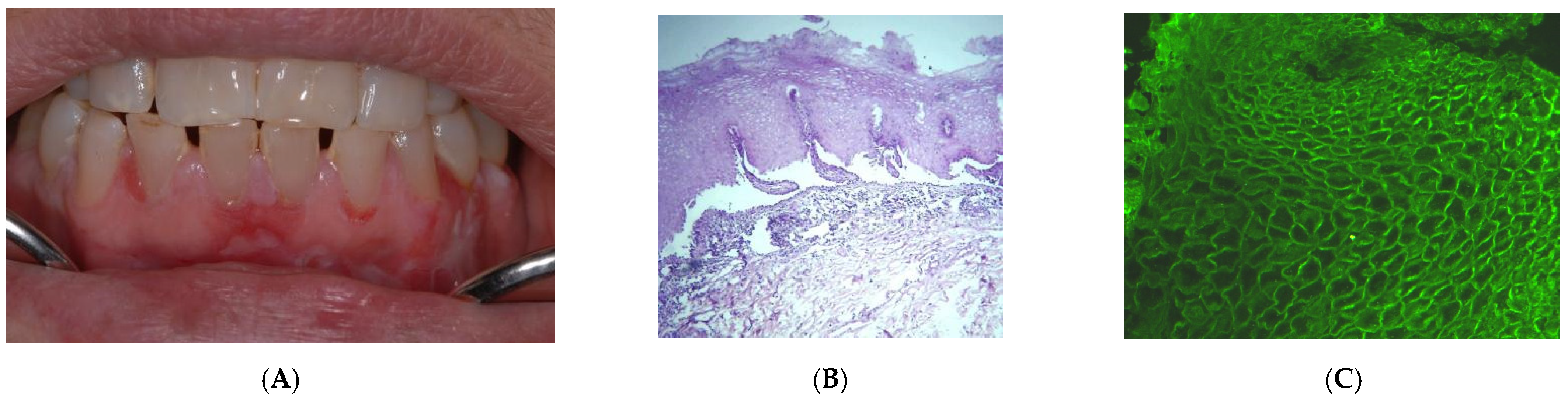 Medicina 60 00167 g002