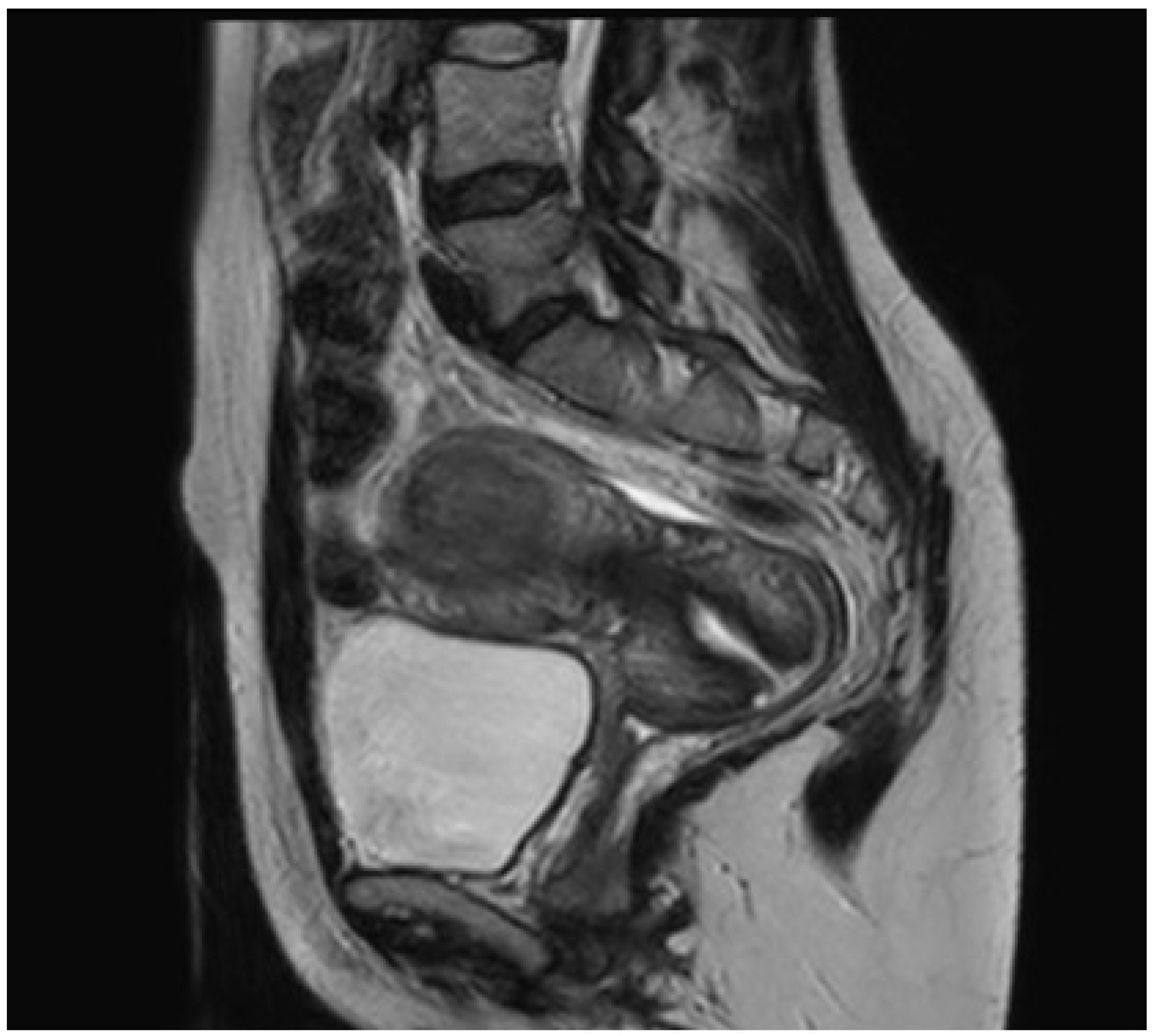 Medicina 60 00179 g003 Medicina 60 00179 g003