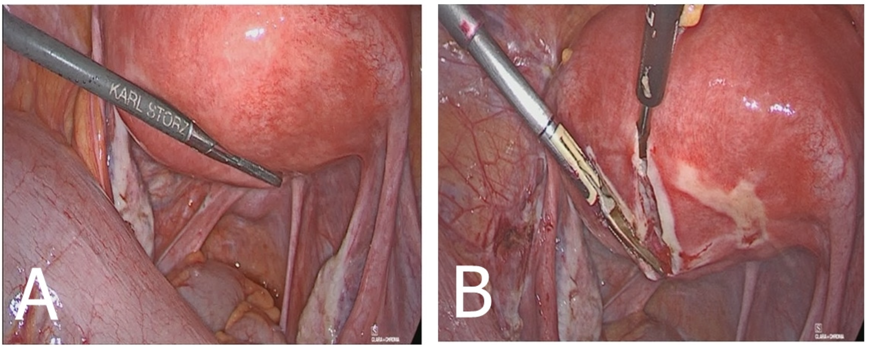 Medicina 60 00179 g004 Medicina 60 00179 g004