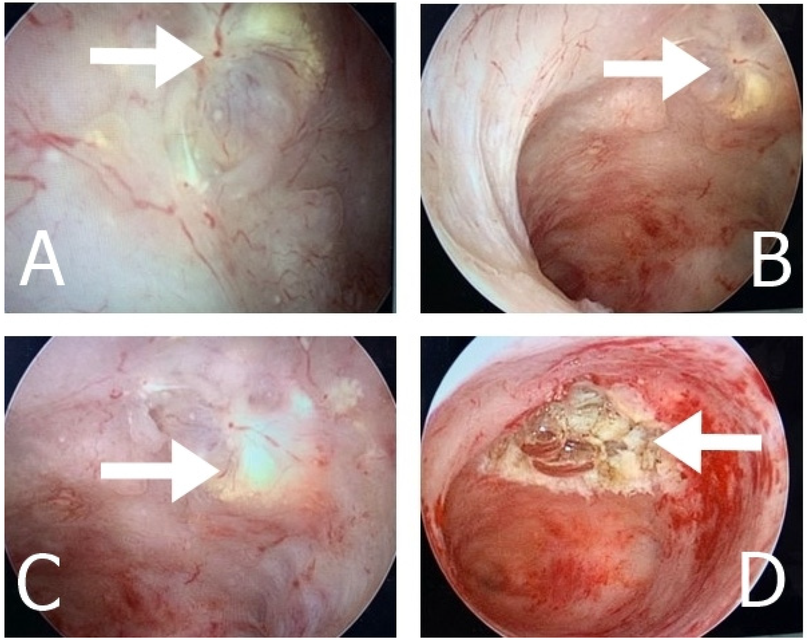 Medicina 60 00179 g005 Medicina 60 00179 g005