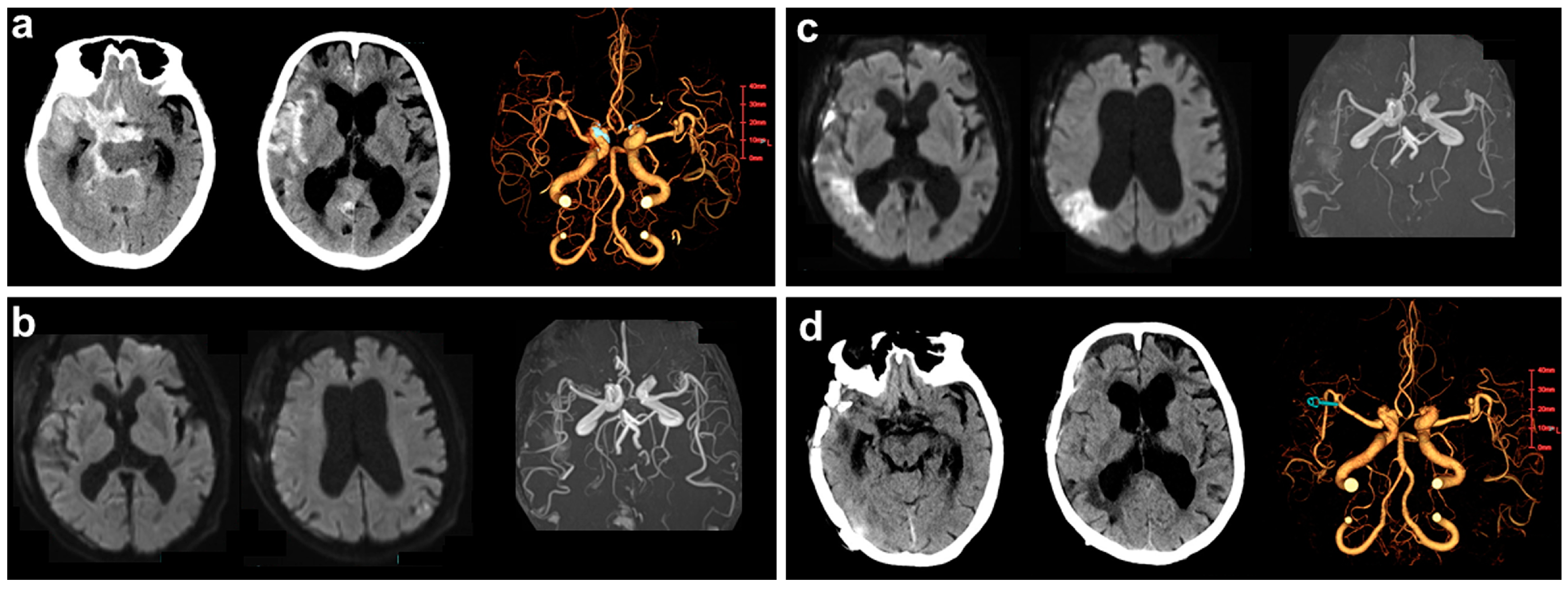 Medicina 60 00185 g001