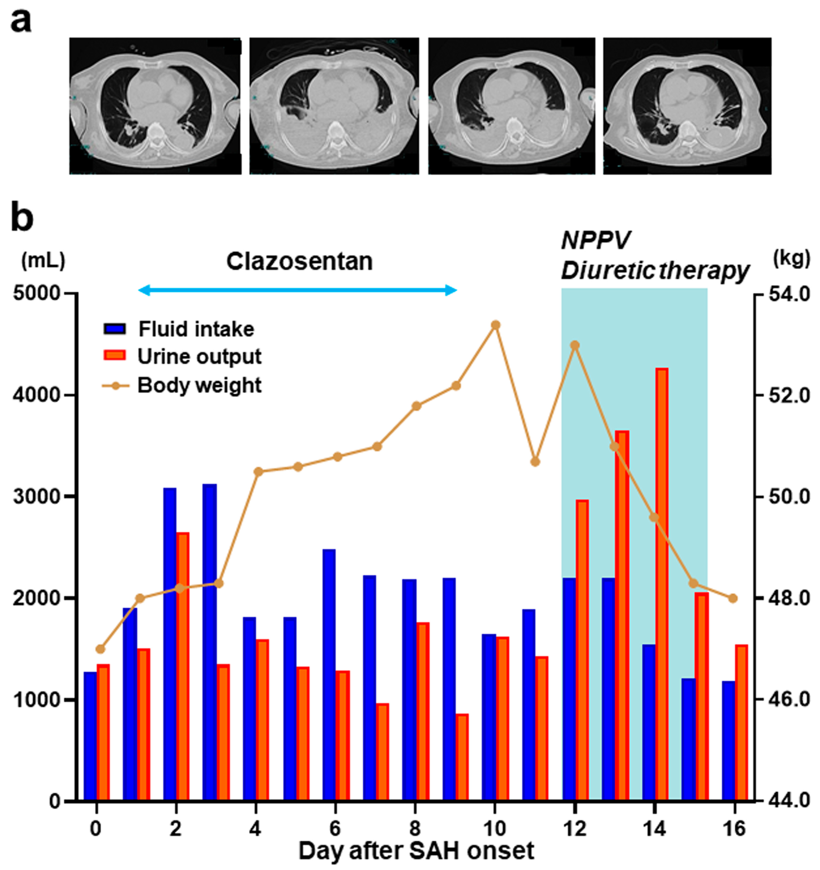 Medicina 60 00185 g002