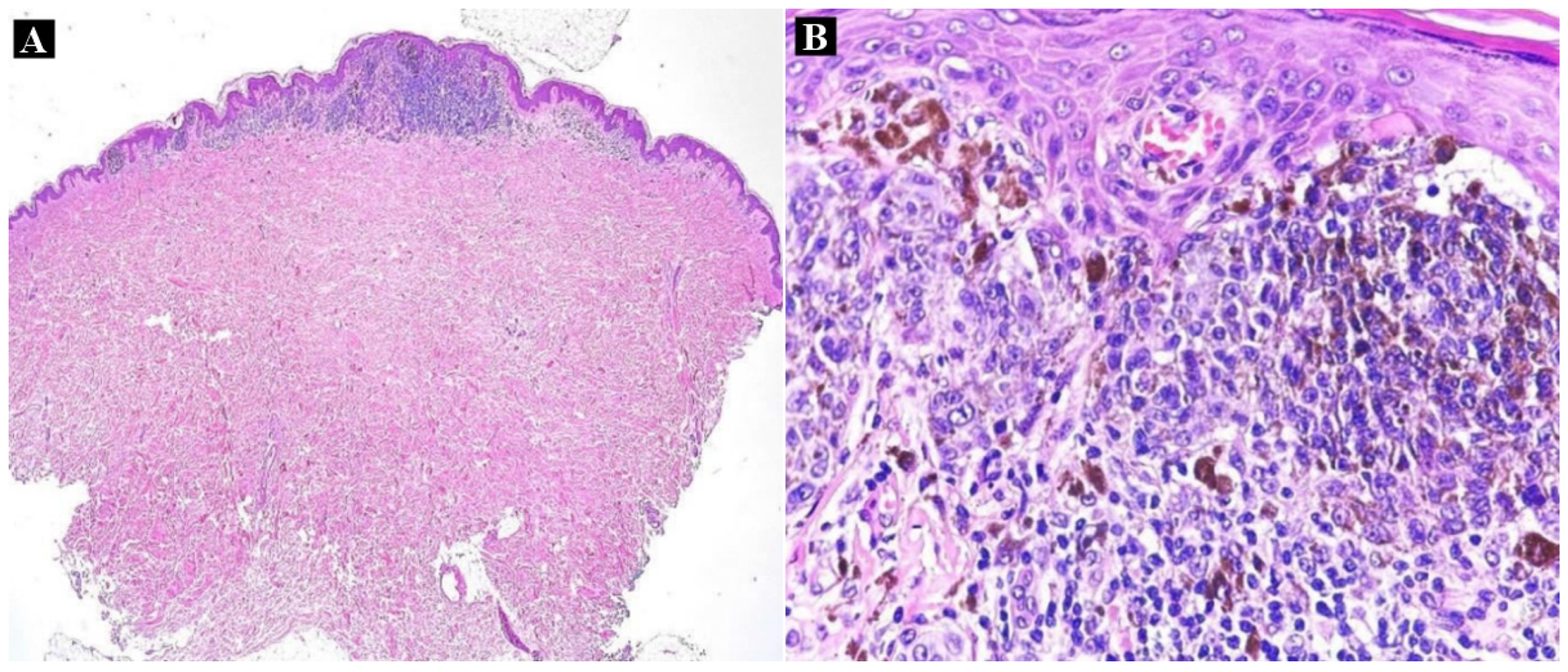 Medicina 60 00187 g002