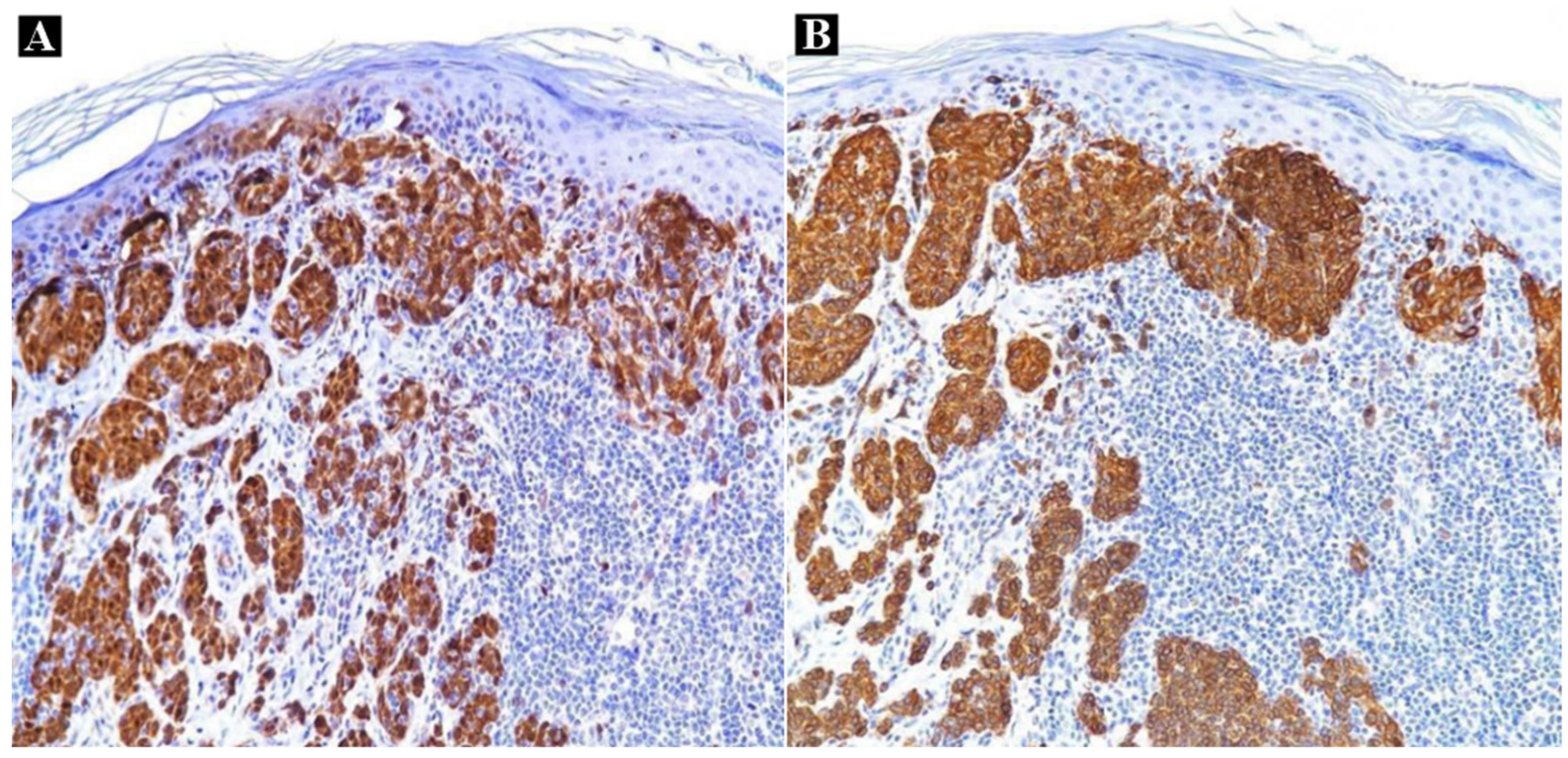 Medicina 60 00187 g003
