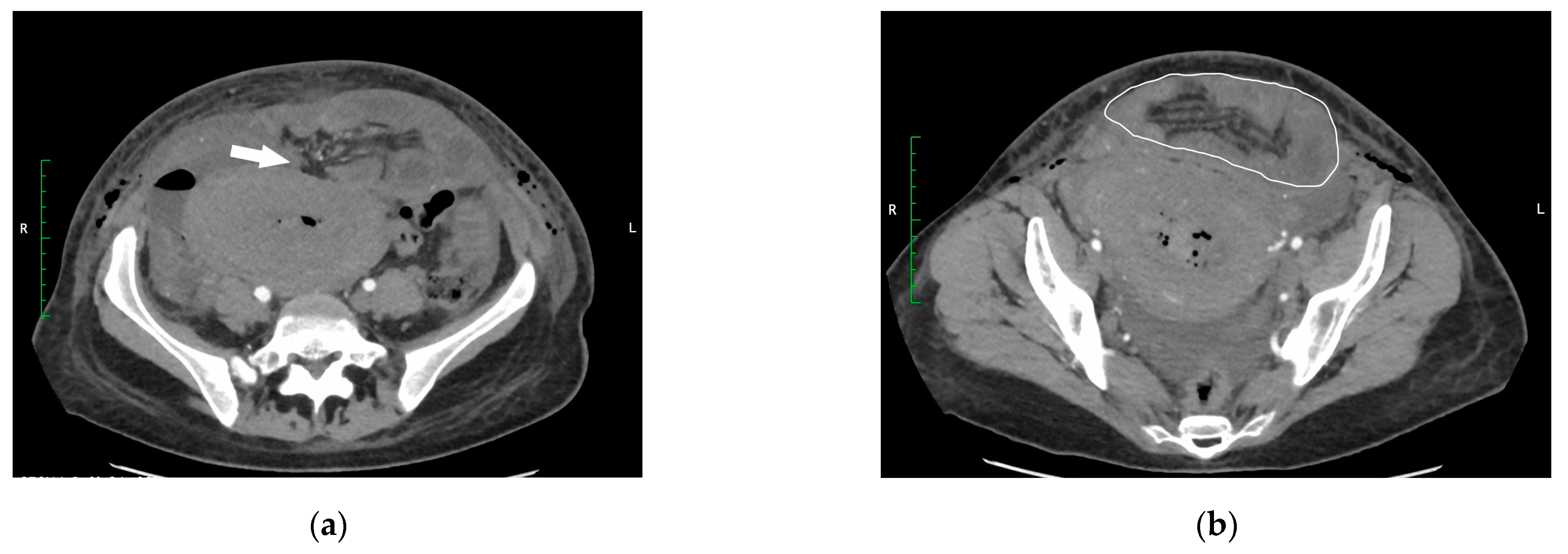 Medicina 60 00190 g001