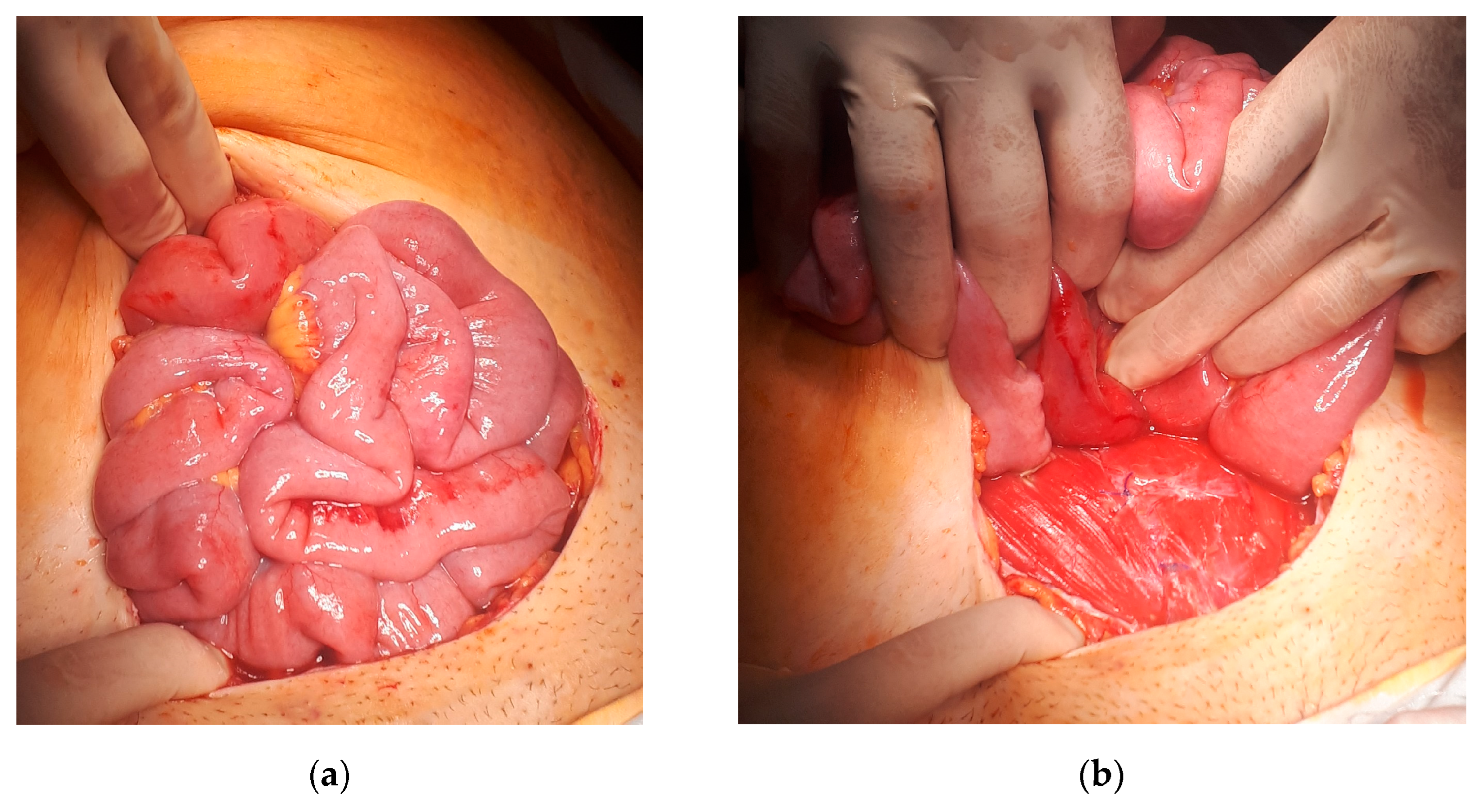 Medicina 60 00190 g002