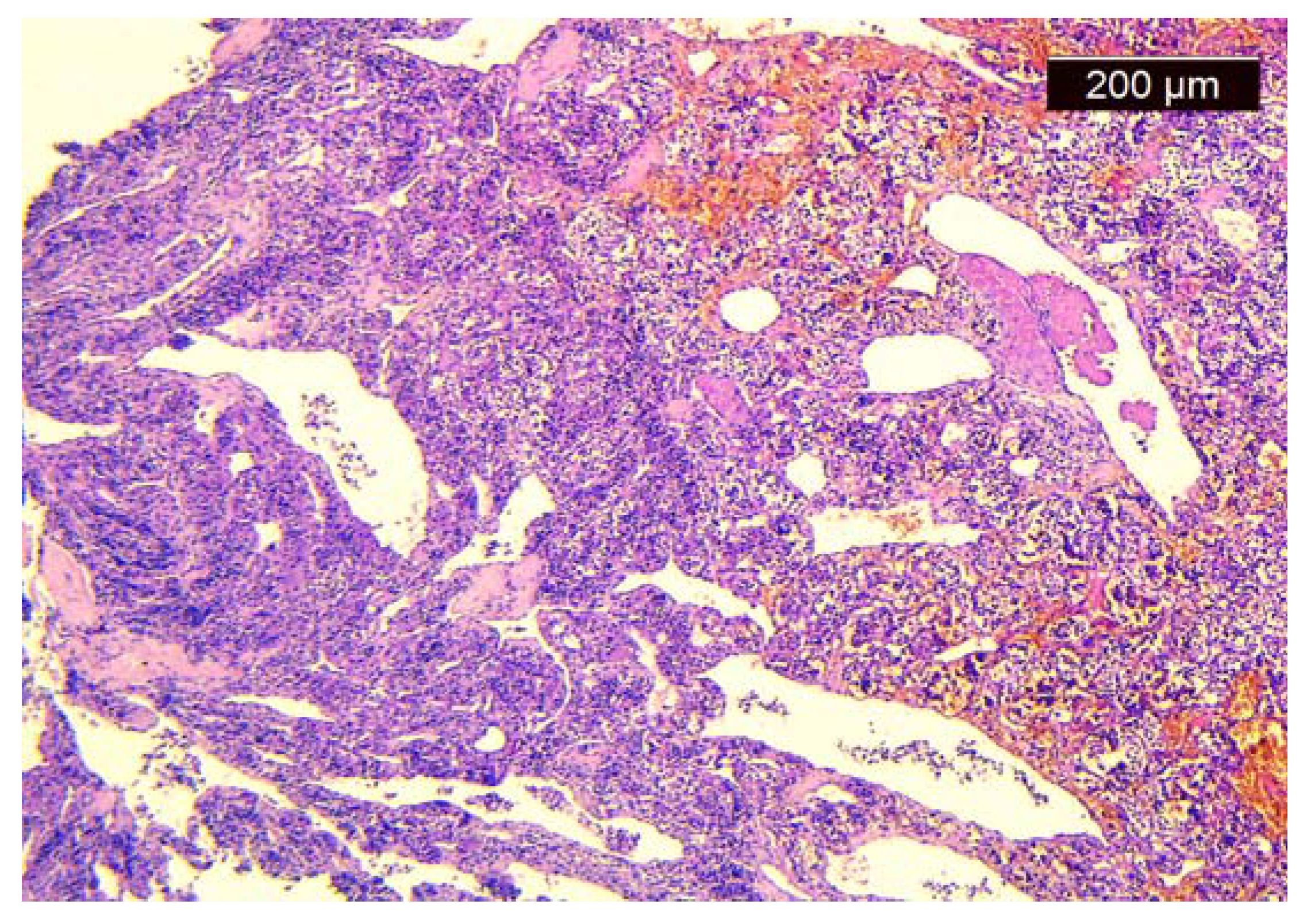 Medicina 60 00198 g003