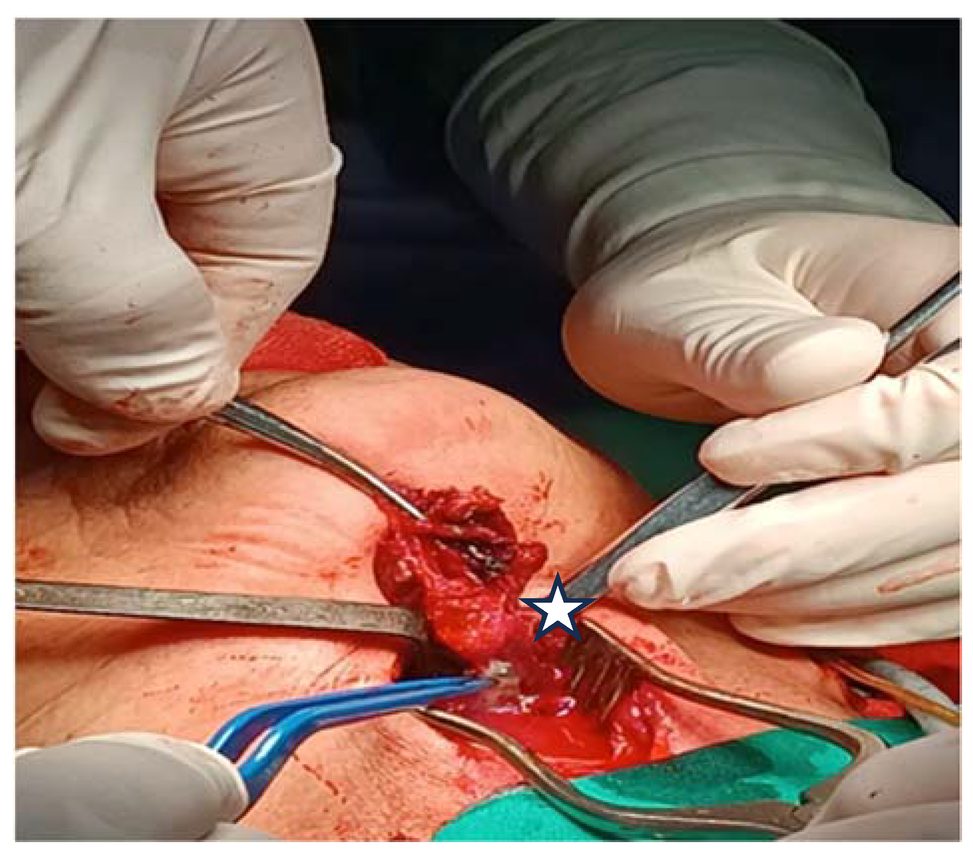 Medicina 60 00198 g005