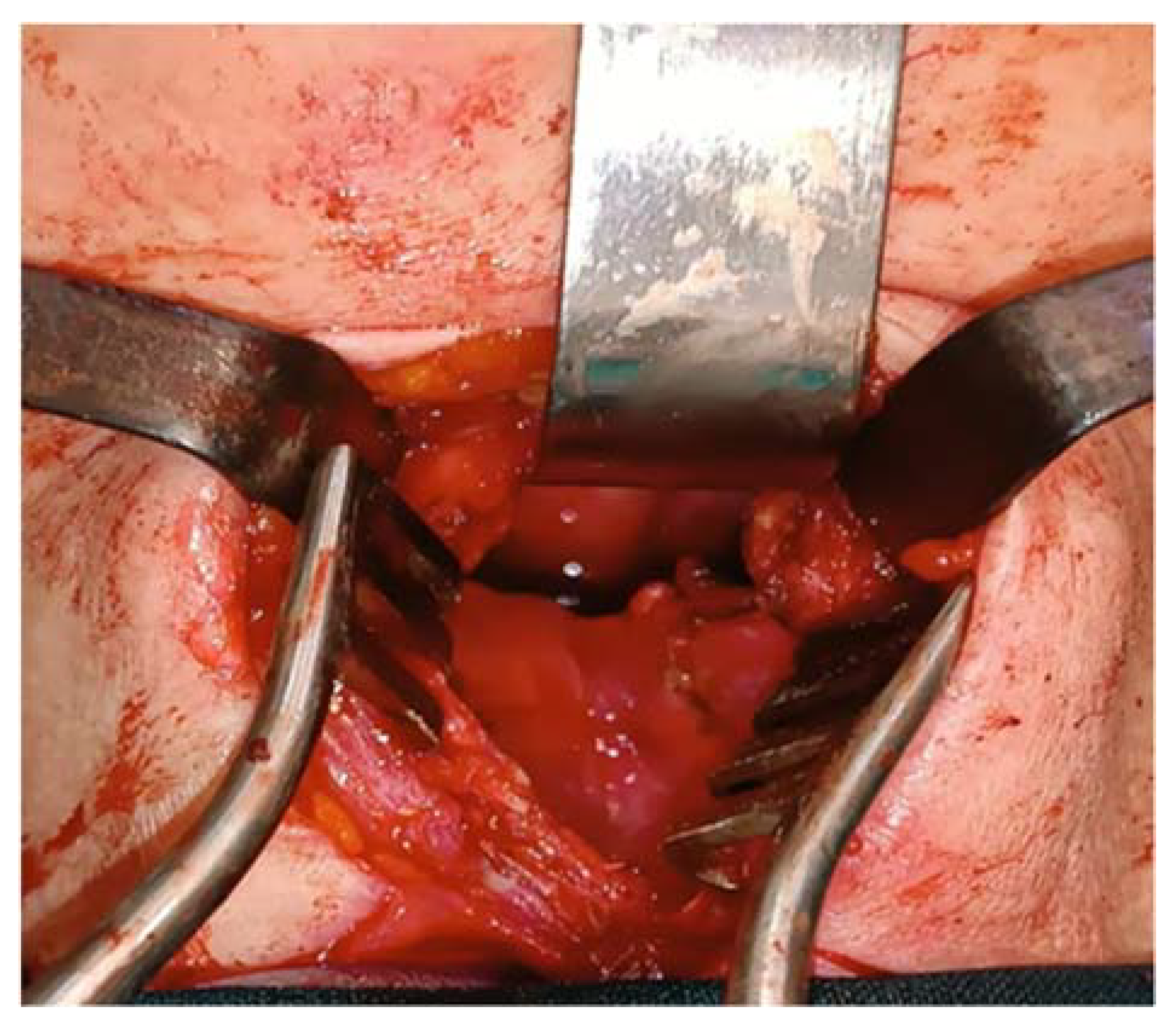 Medicina 60 00198 g006