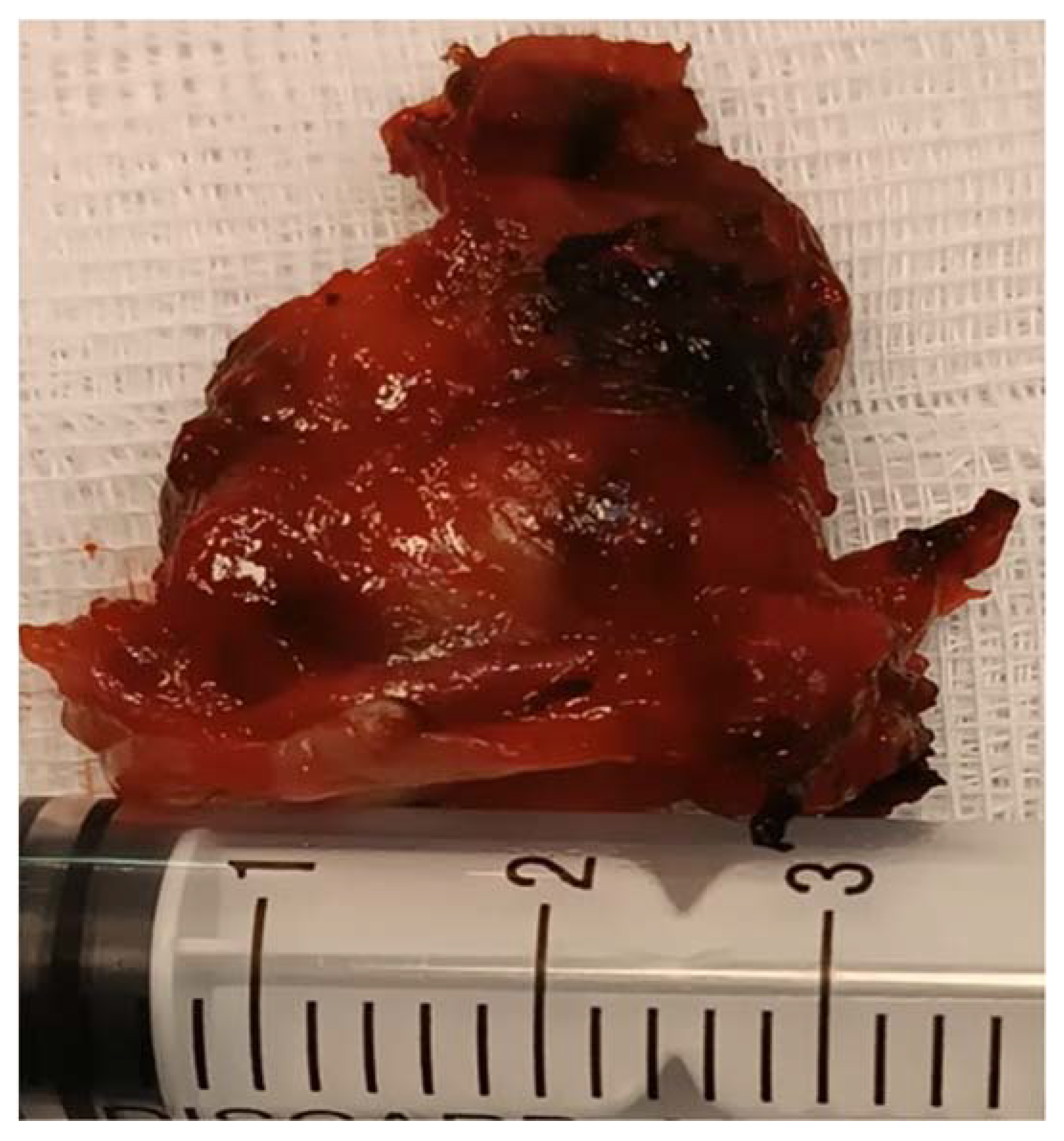 Medicina 60 00198 g007