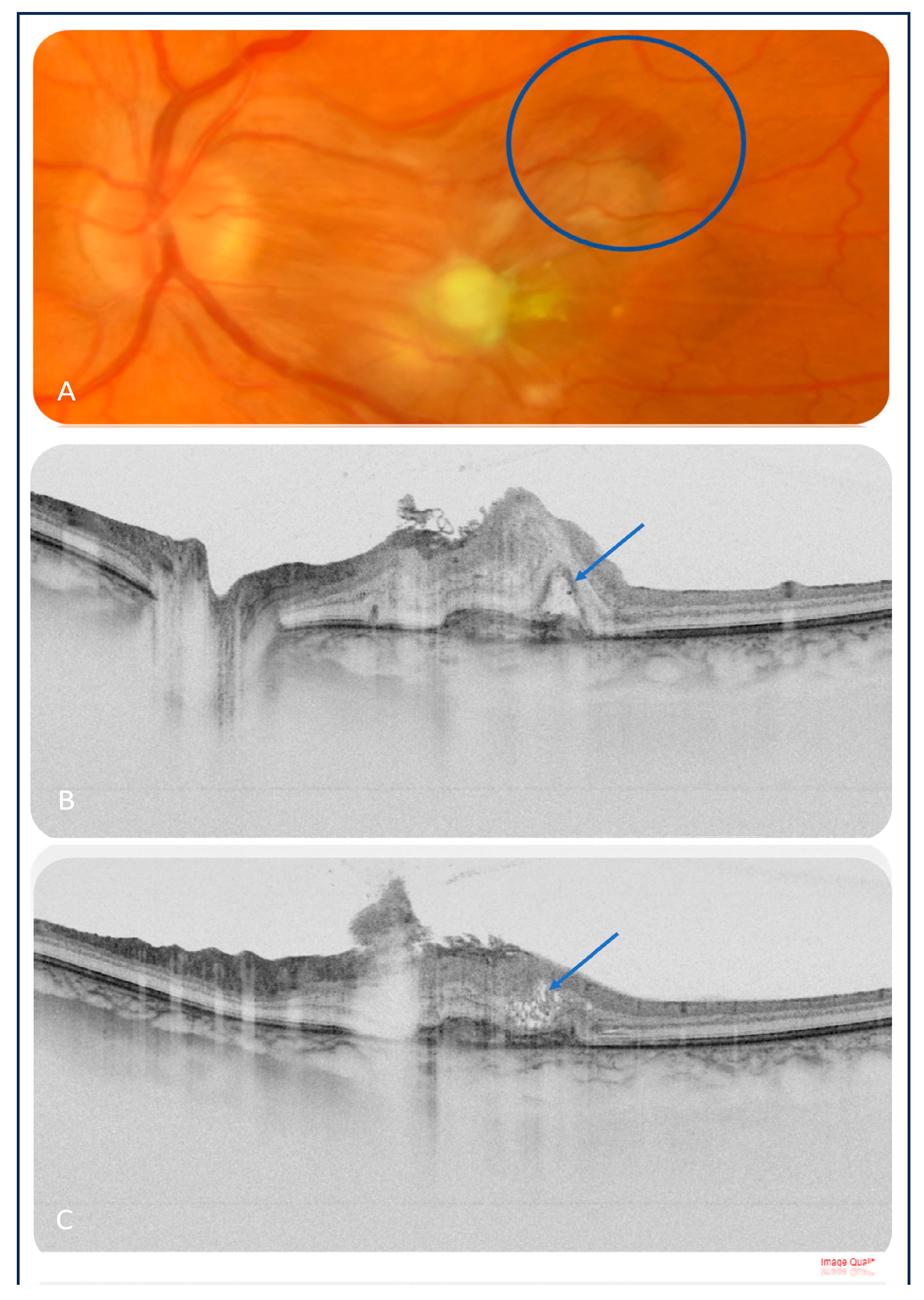 Medicina 60 00207 g003