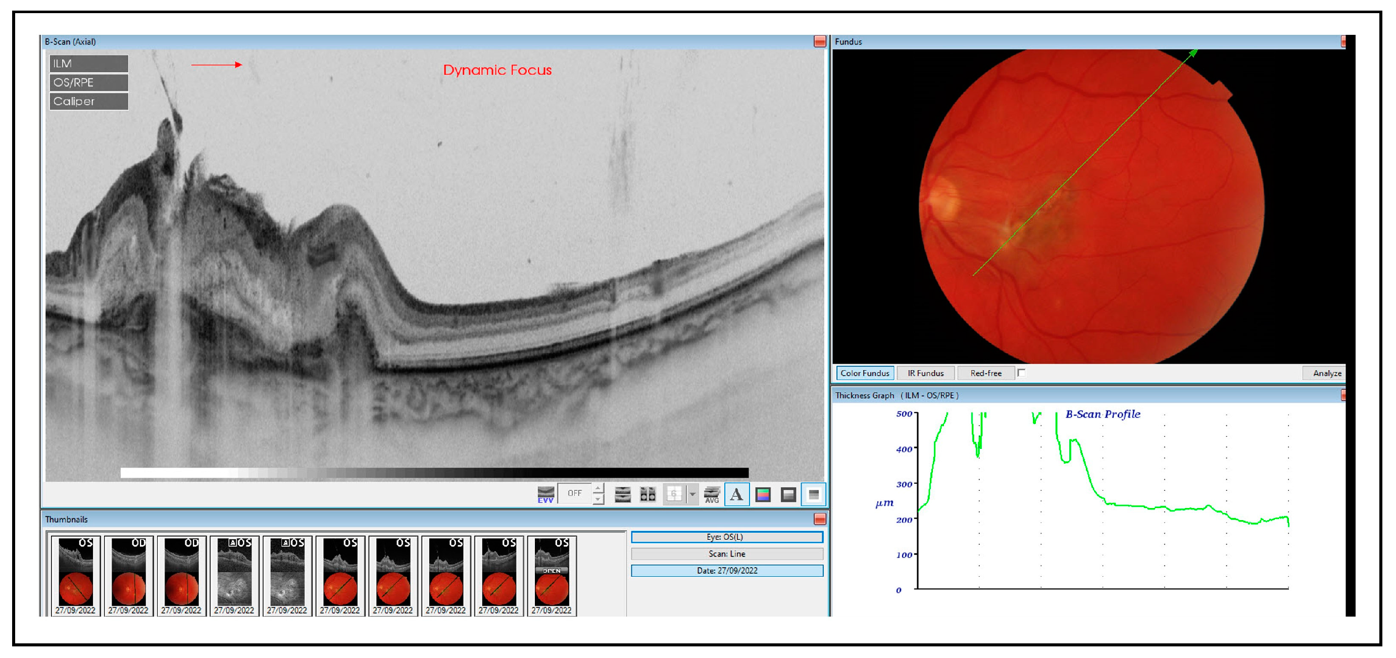 Medicina 60 00207 g005