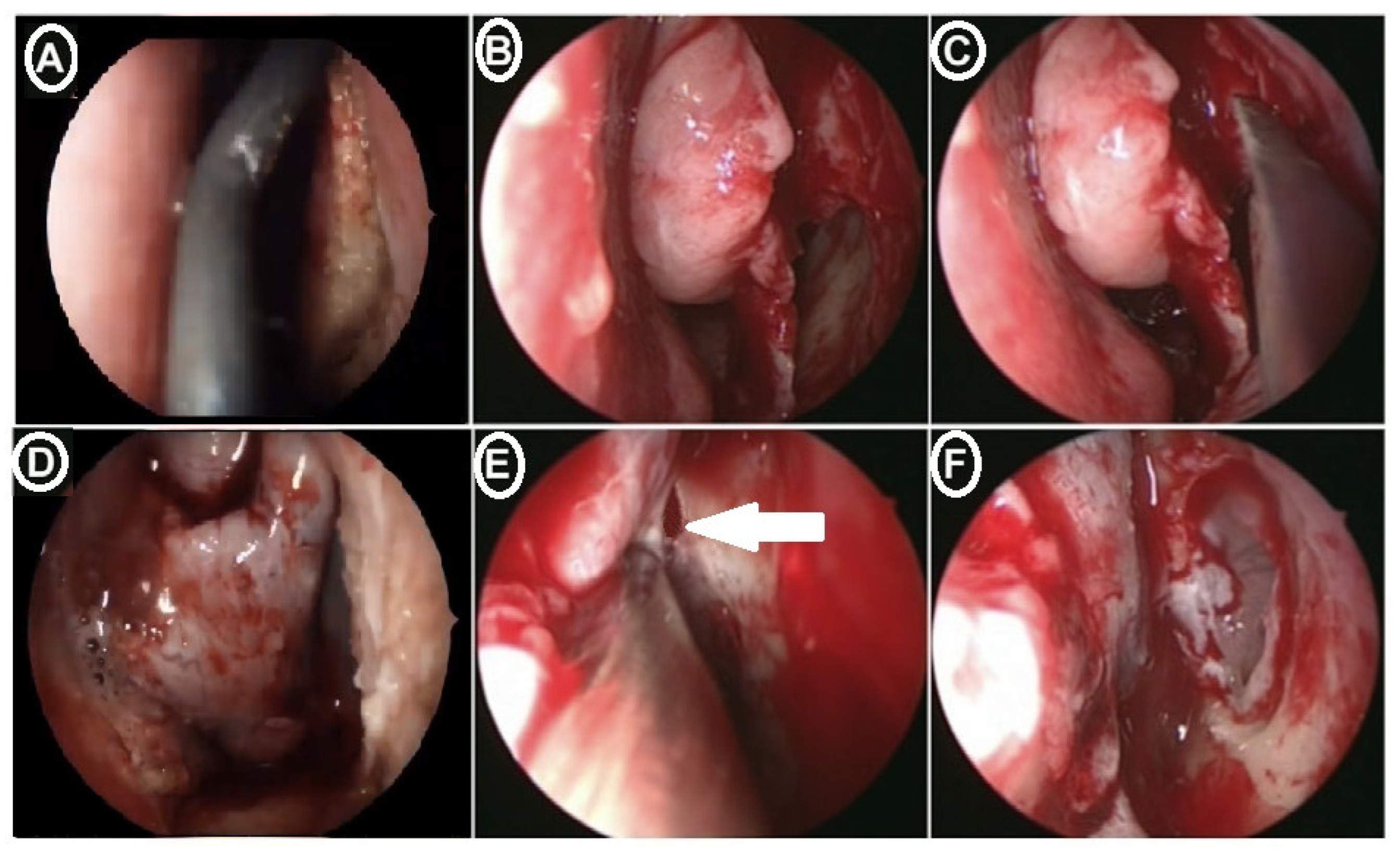 Medicina 60 00222 g004