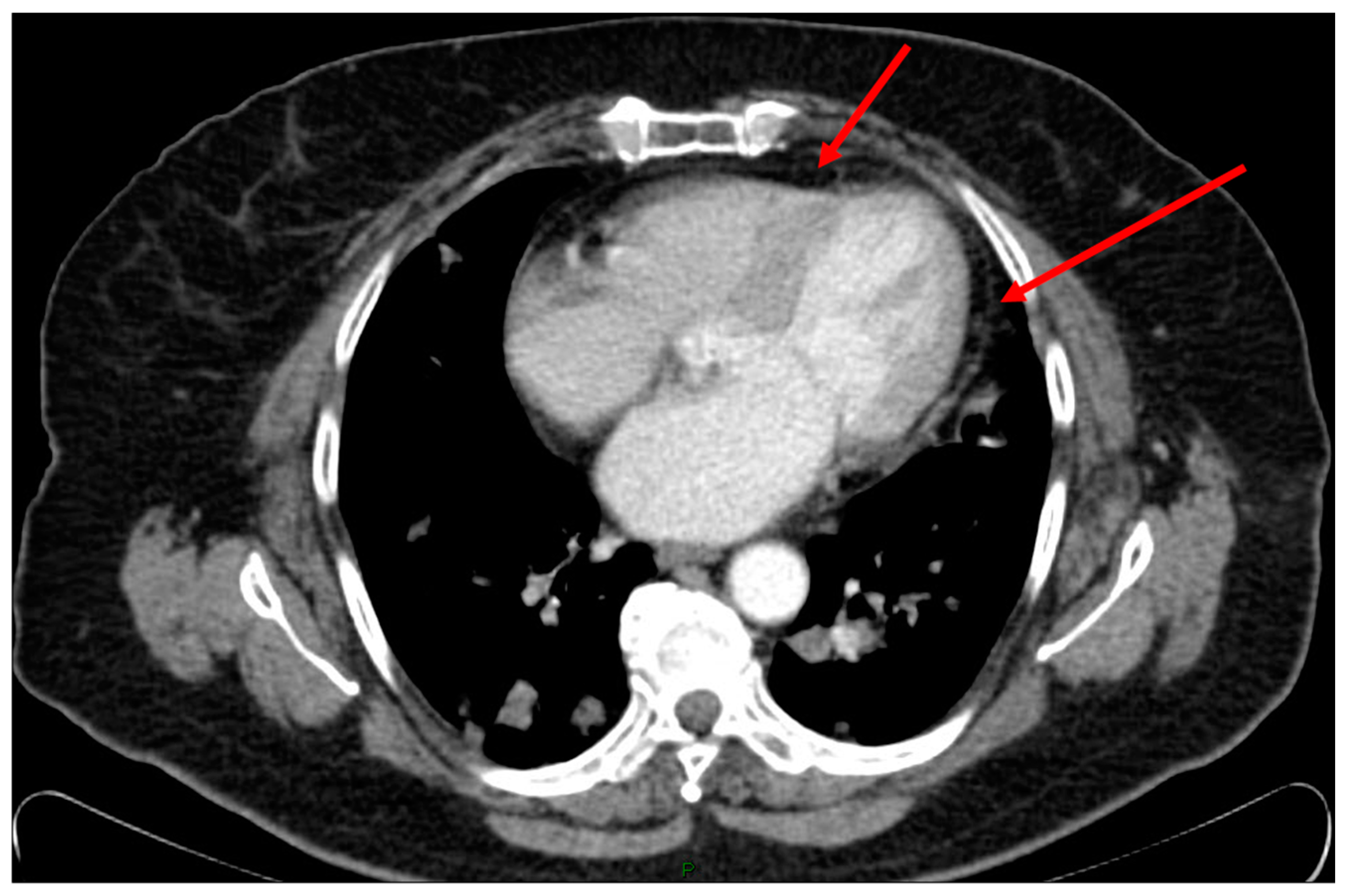 Medicina 60 00224 g001