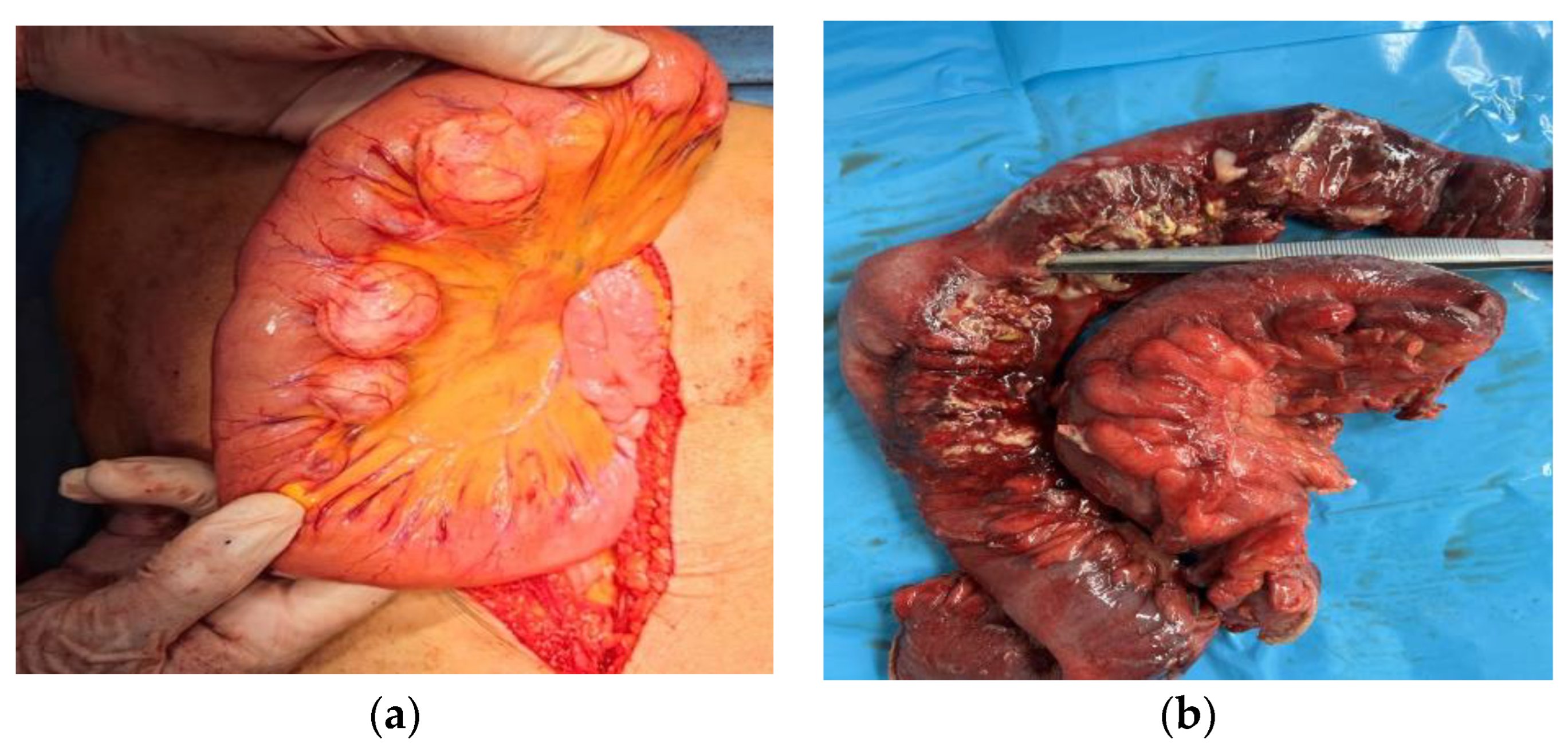 Medicina 60 00229 g002