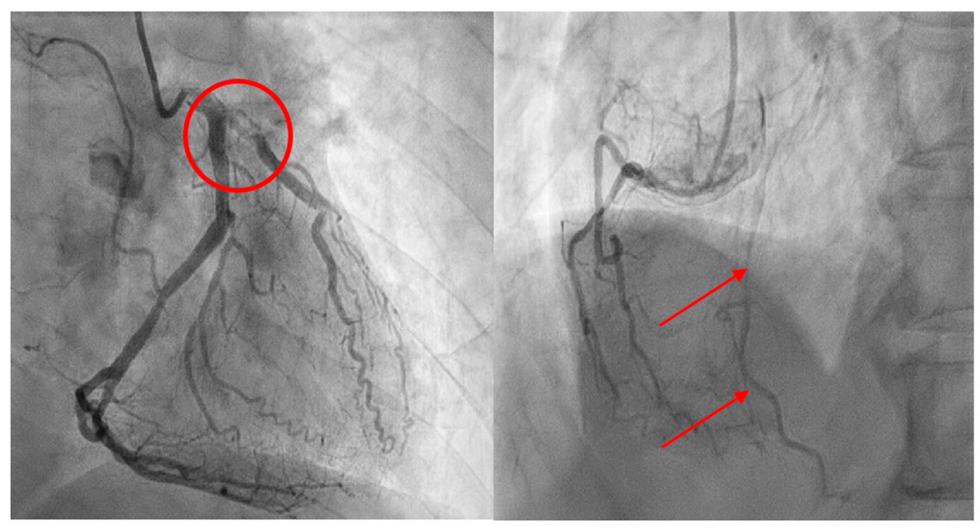 Medicina 60 00232 g004 Medicina 60 00232 g004