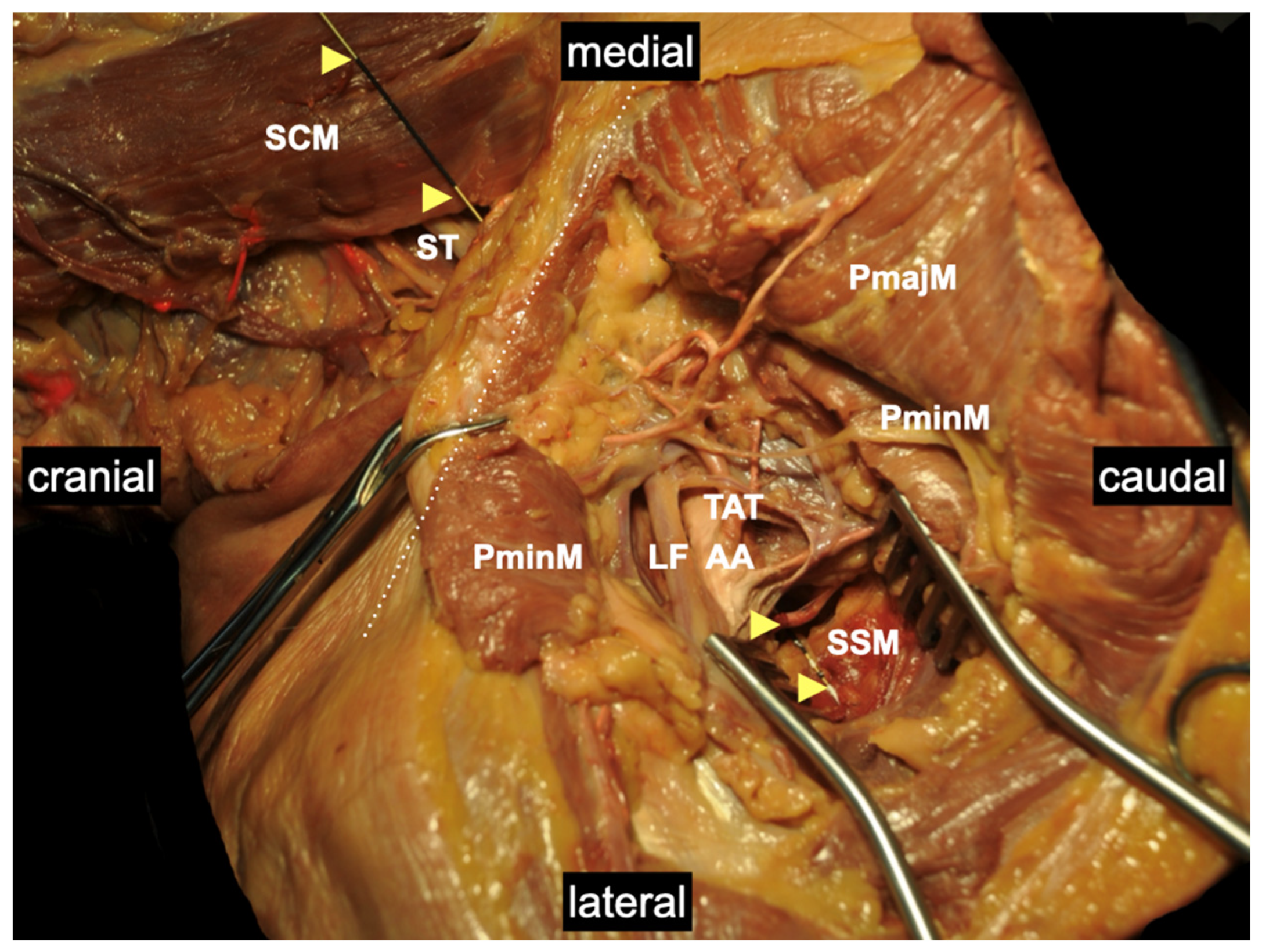 Medicina 60 00233 g007