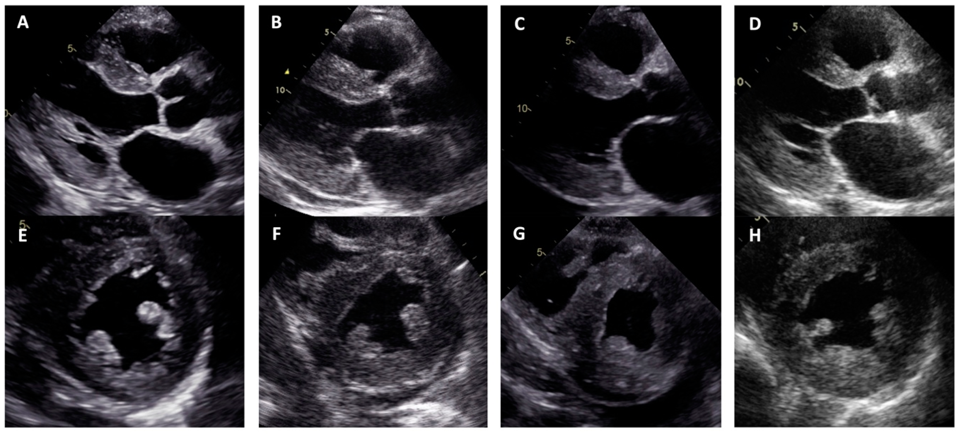 Medicina 60 00237 g002