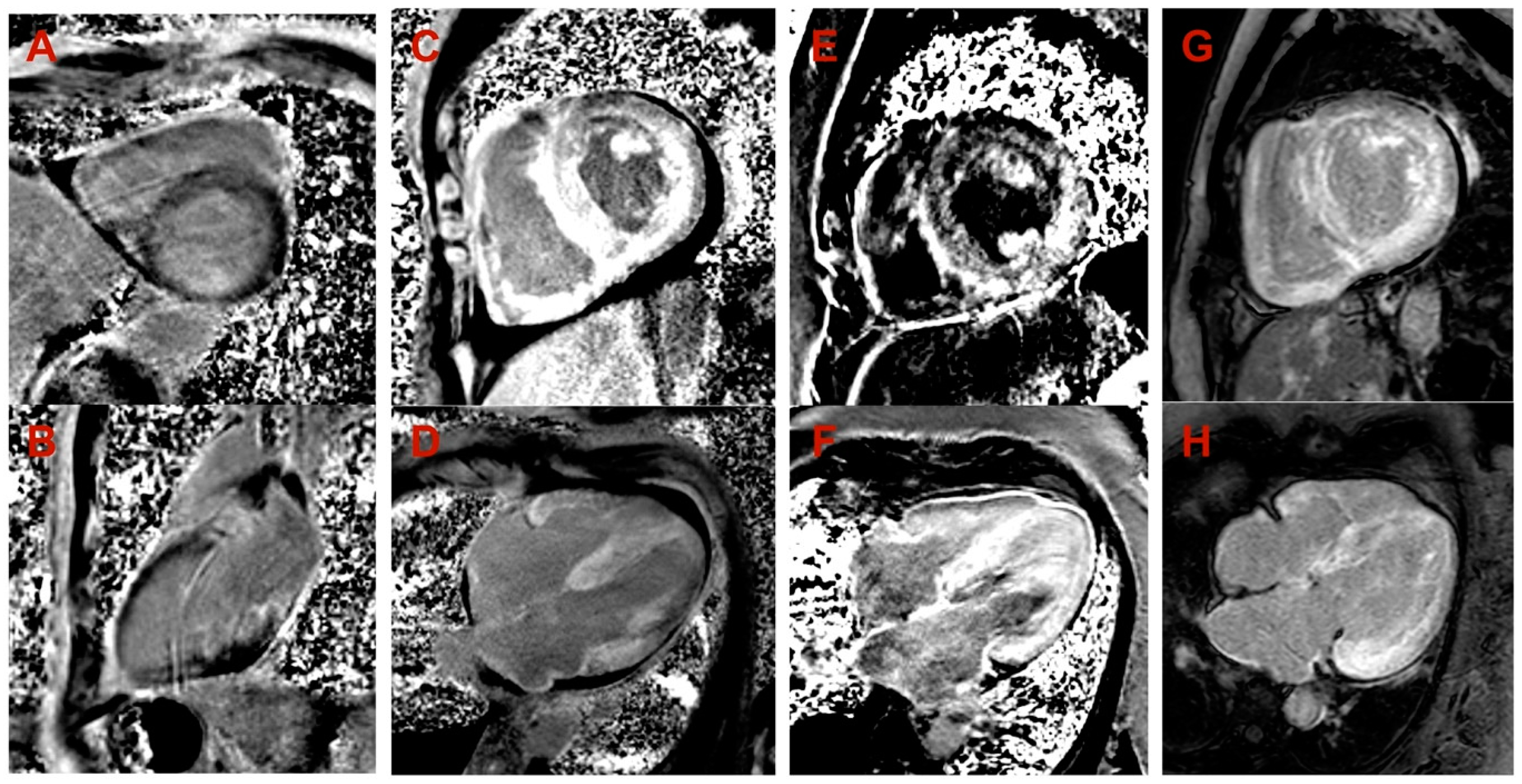 Medicina 60 00237 g003