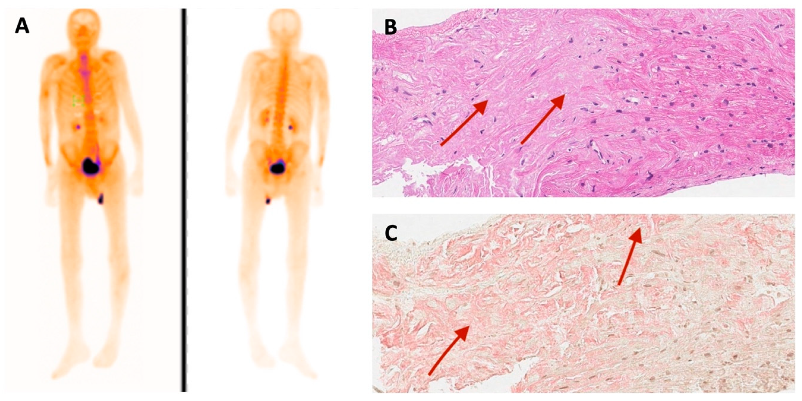 Medicina 60 00237 g005