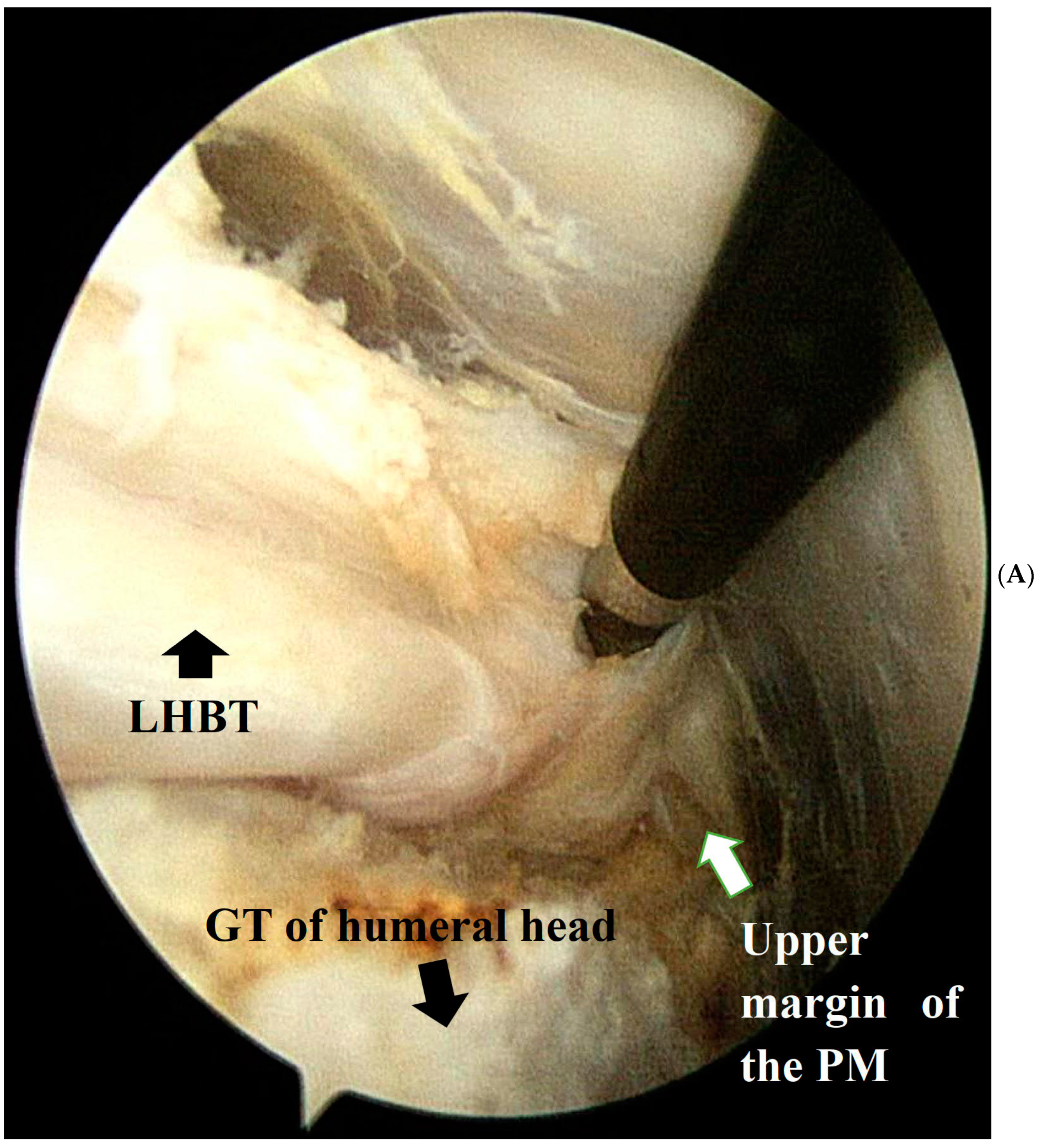 Medicina 60 00240 g001a