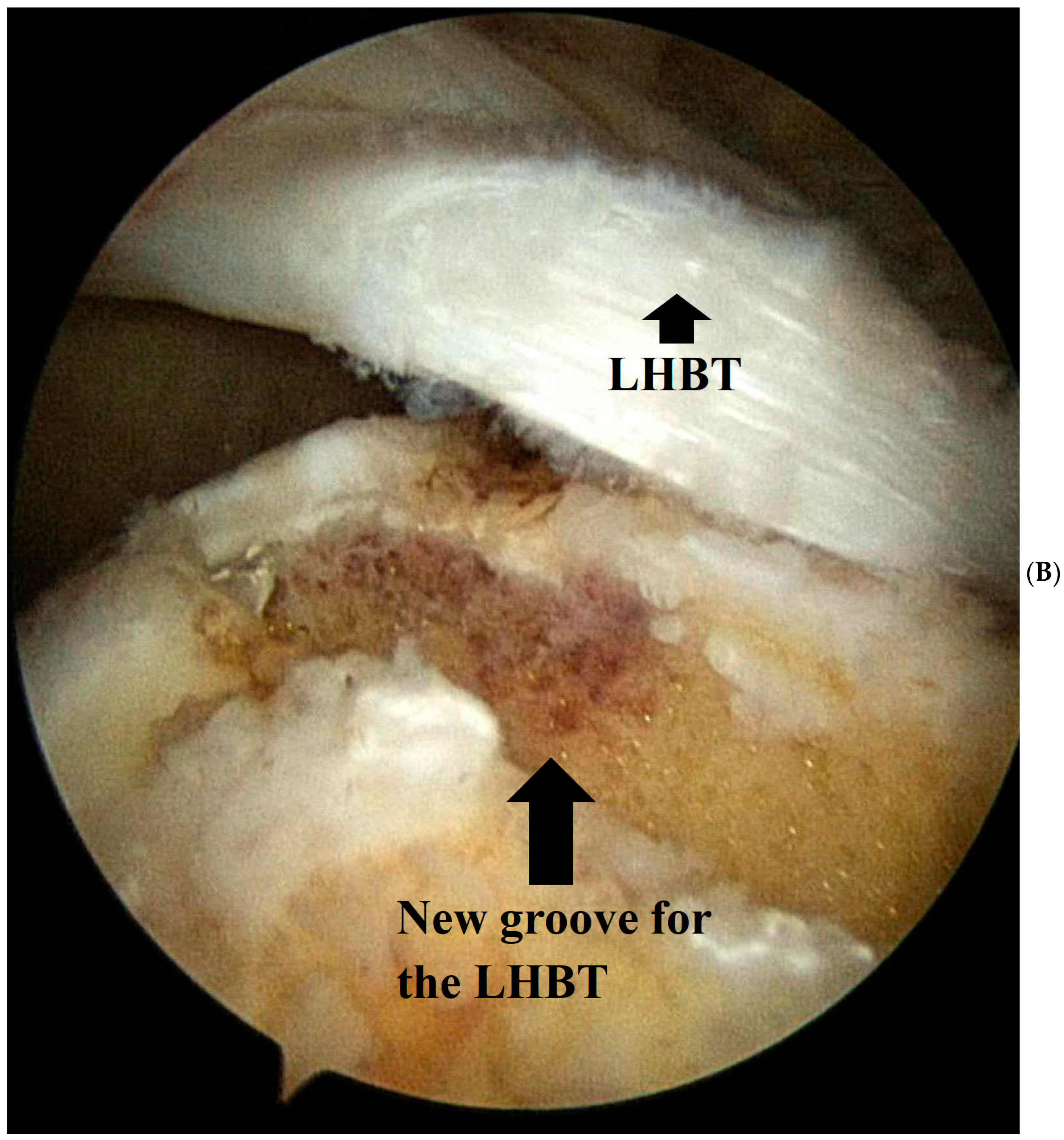 Medicina 60 00240 g001b