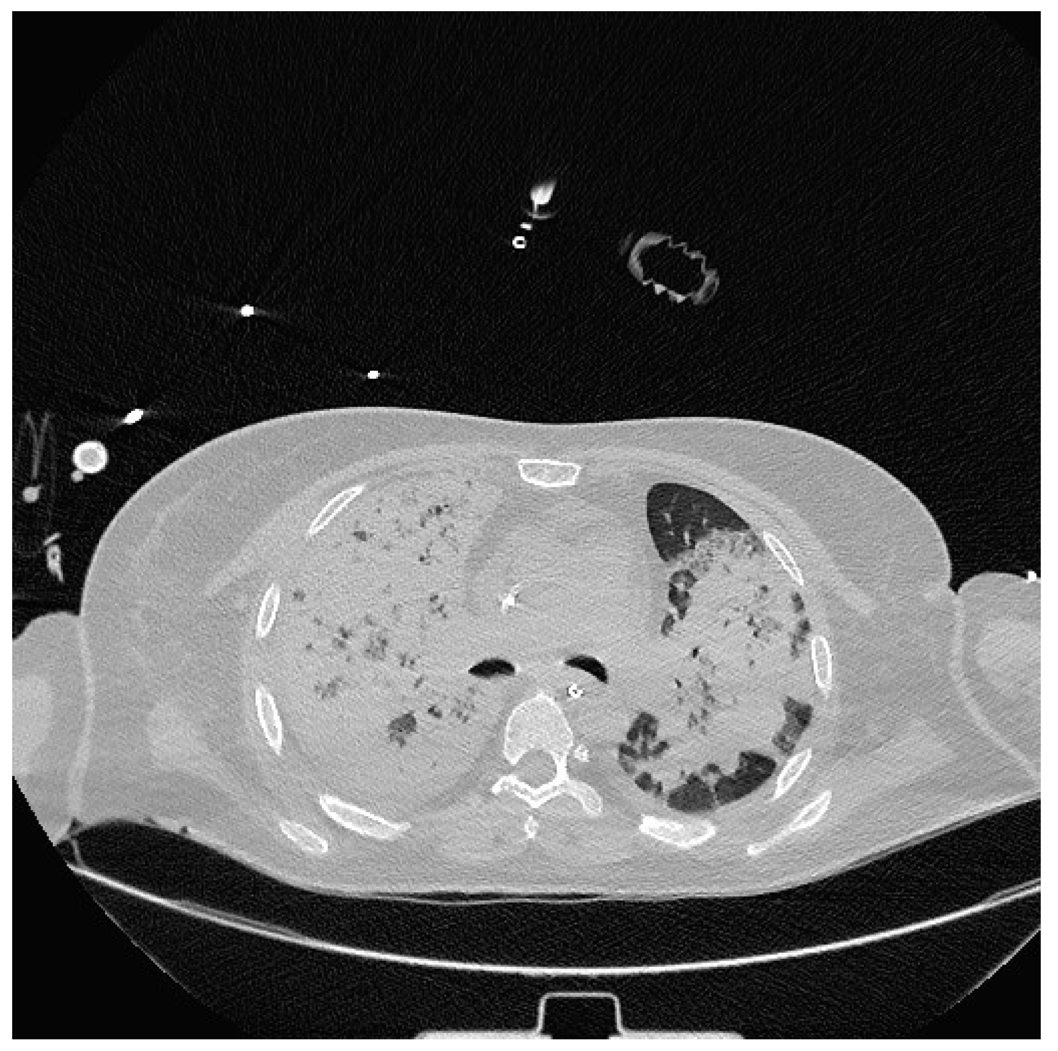 Medicina 60 00242 g002 Medicina 60 00242 g002