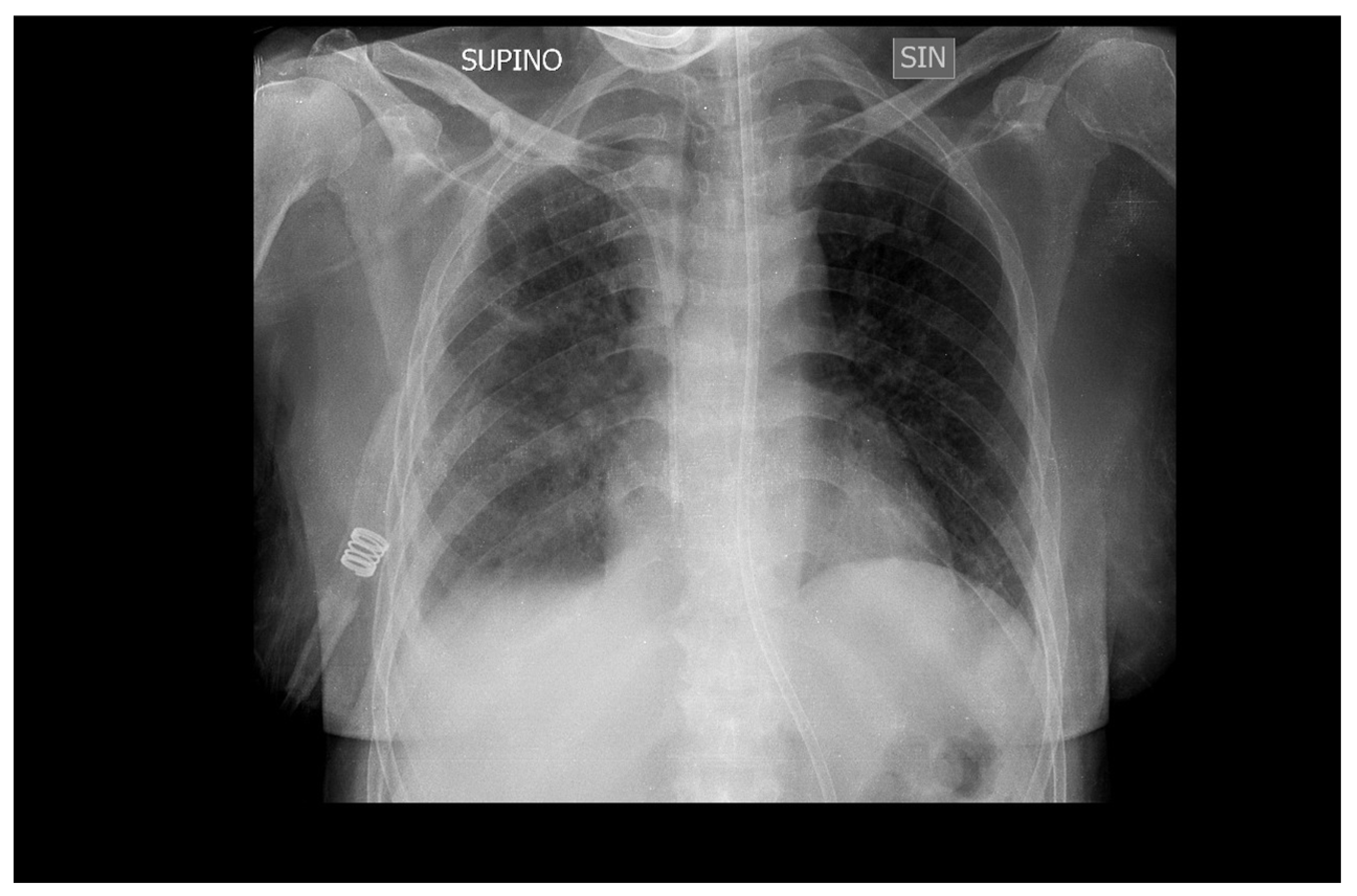 Medicina 60 00242 g004 Medicina 60 00242 g004