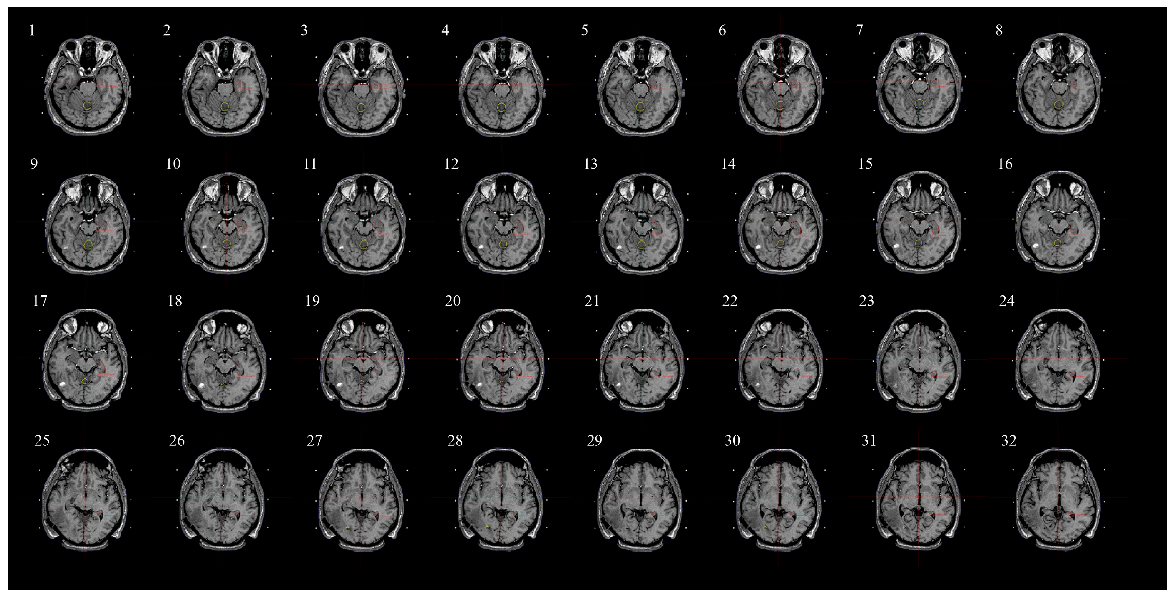 Medicina 60 00246 g002