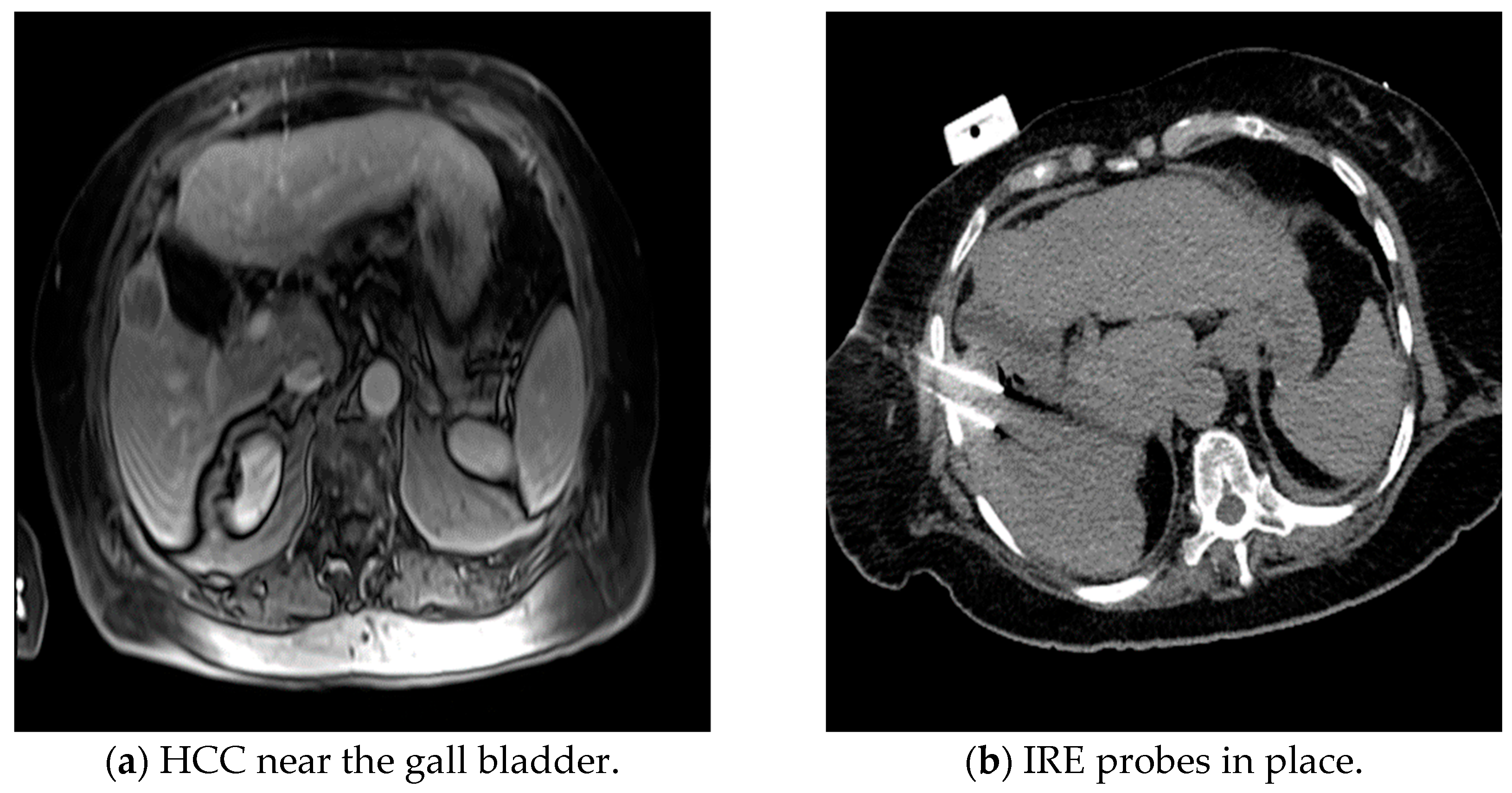 Medicina 60 00251 g001a
