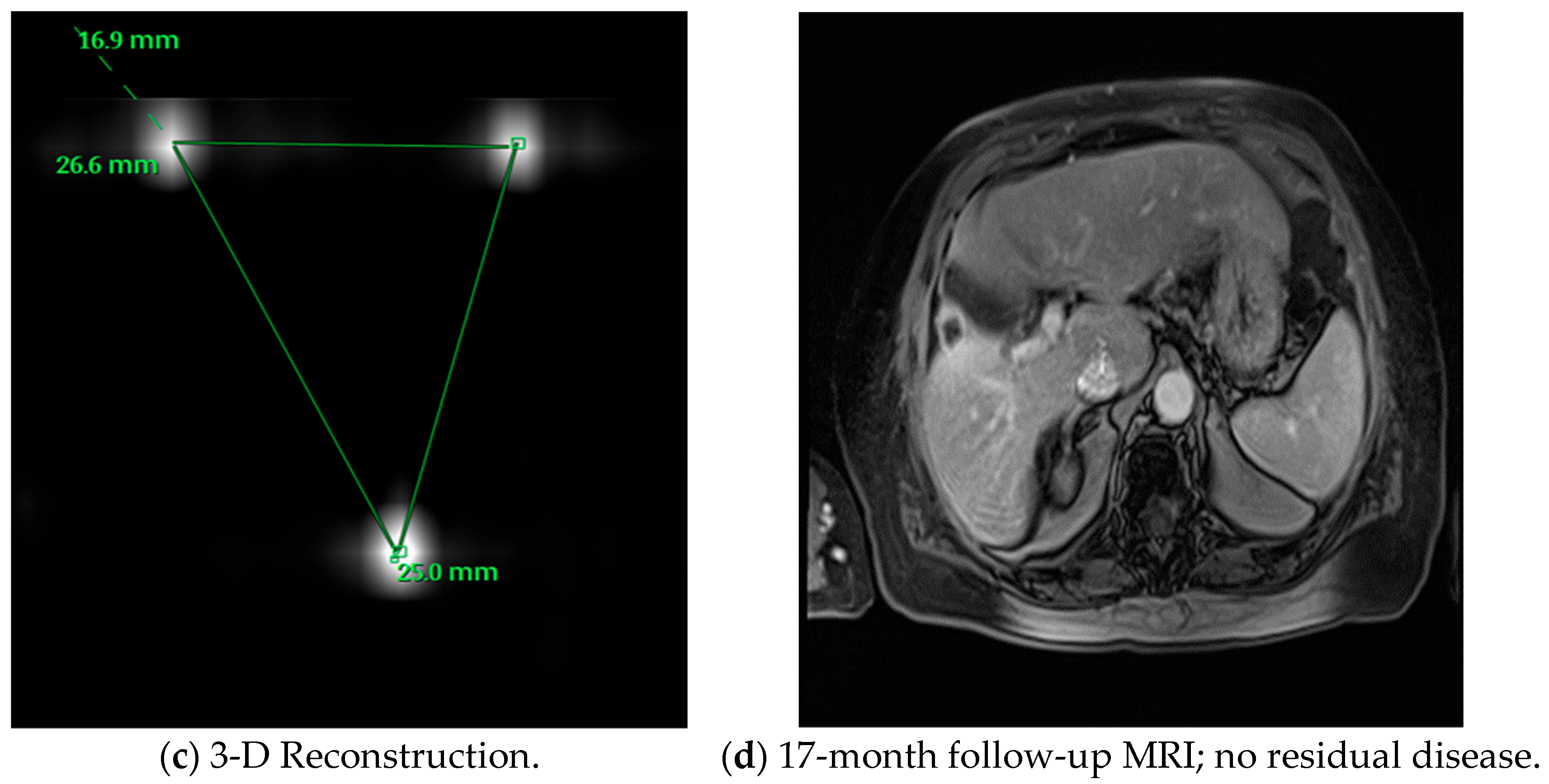 Medicina 60 00251 g001b