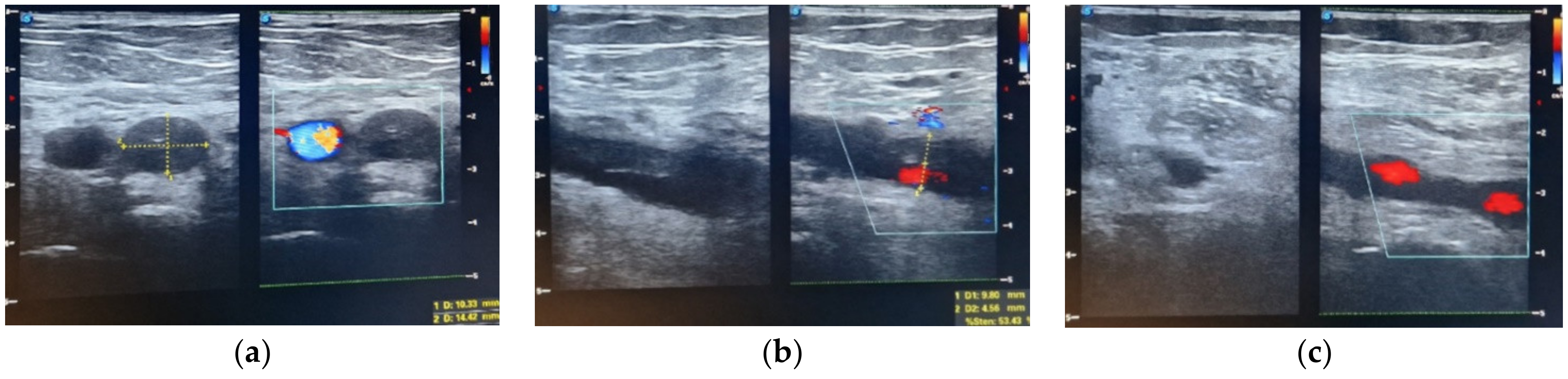 Medicina 60 00258 g002